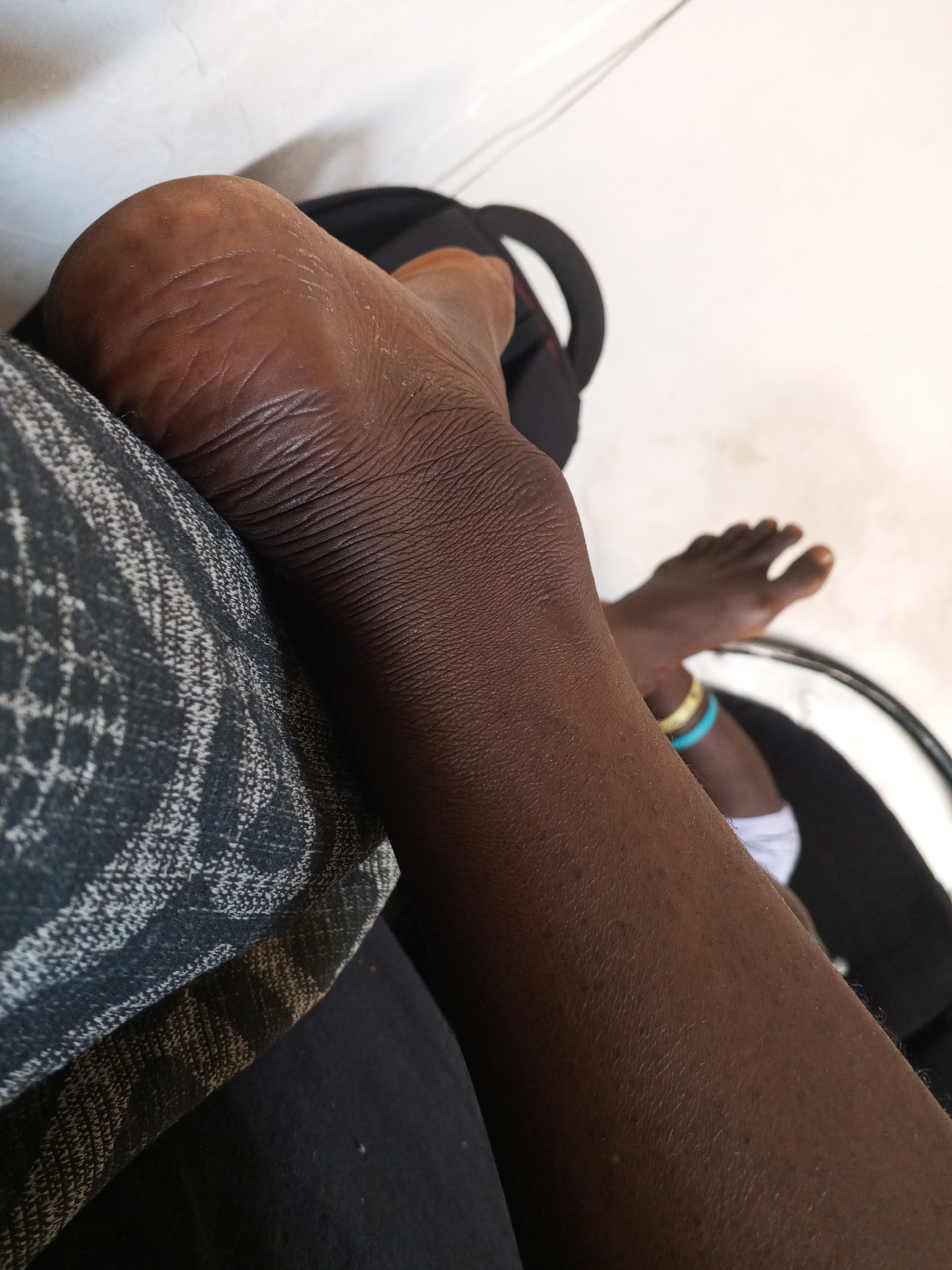 A close-up shot shows a dark-skinned person's legs crossed, with one foot resting on a patterned cushion. The other foot is visible in the background, adorned with an ankle bracelet. The setting is indoors, with a white wall visible. The context of Gwong, Nigeria, is not discernible from the image.