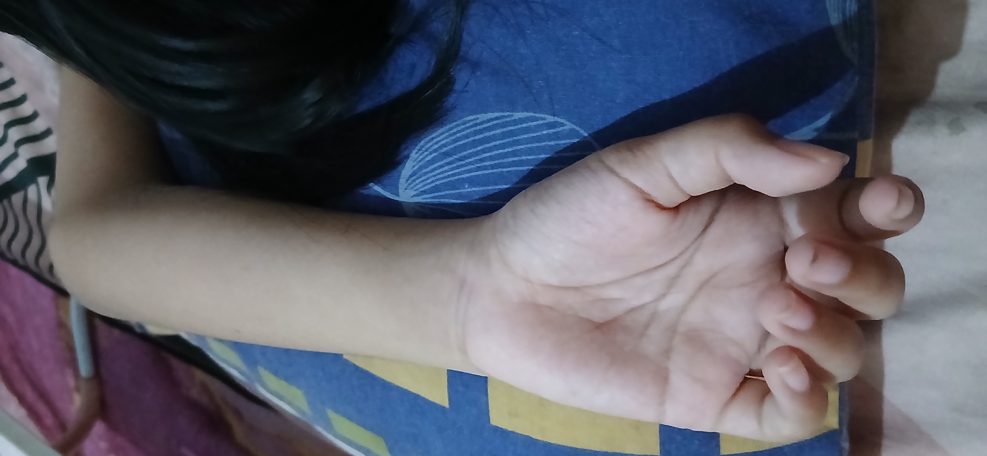 An underexposed, close-up shot focuses on a person's arm and hand resting on a blue and yellow patterned surface. The arm, from the elbow down, is pale and appears to be resting on a pillow or bed. The hand is positioned palm-up, with fingers gently curled inwards. The background shows a pink and striped fabric, likely part of a bedspread. The lighting is dim, creating shadows that obscure fine details of the environment. There is no identifiable location in the city of Samarinda, Indonesia visible in this image.