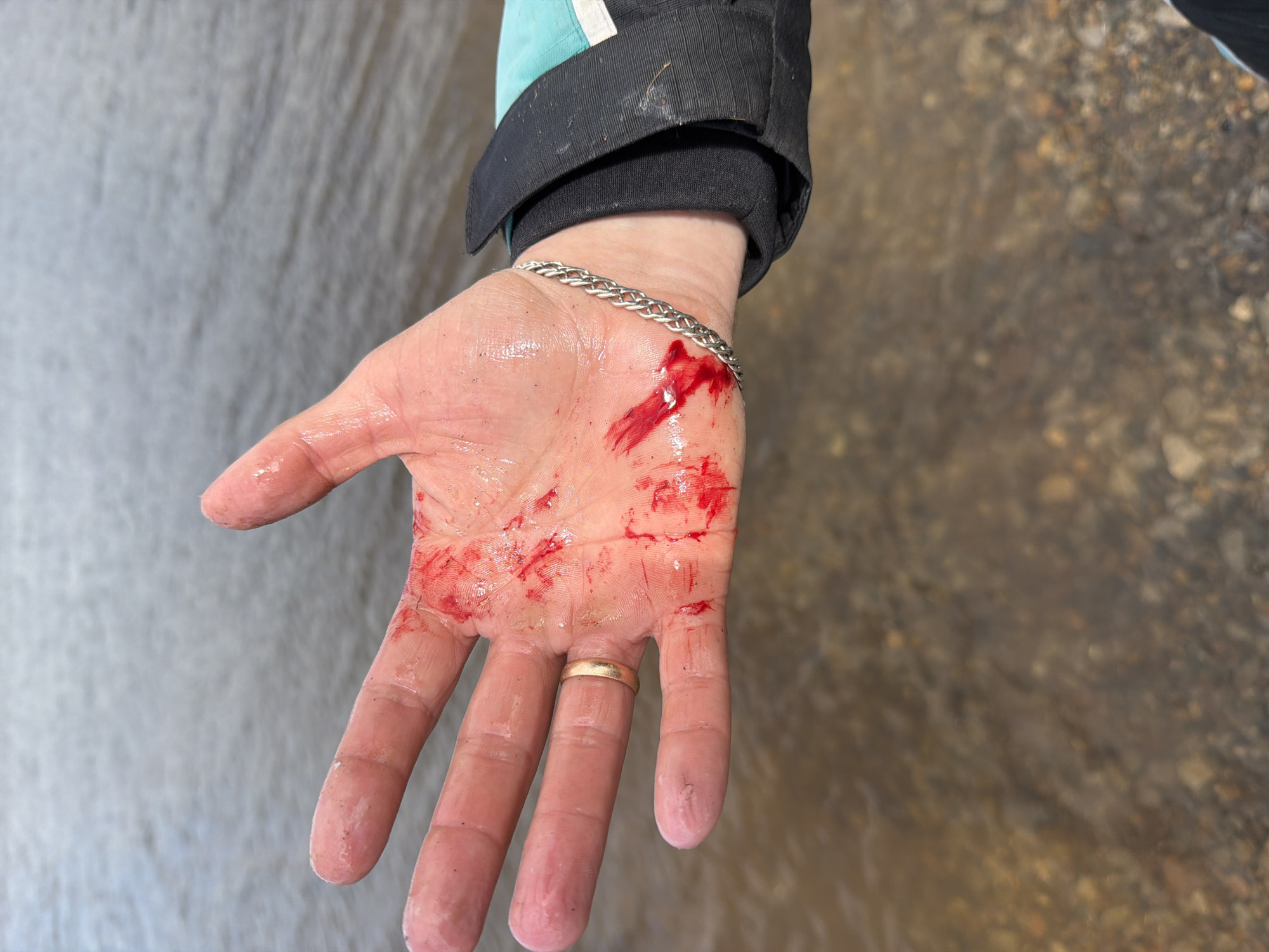 A close-up shot depicts a person's left hand, palm facing upwards, covered in fresh red blood. The blood is smeared across the palm and the base of the fingers, with a more concentrated area and distinct streak near the thumb and wrist. A silver chain-link bracelet adorns the wrist, and a plain gold band ring is worn on the fourth finger. The hand and fingers appear wet and slightly grimy.
The person's forearm is partially visible, extending from the top left, wearing a black and light blue jacket sleeve with a black cuff. The background consists of a body of water. On the left, the water appears lighter and somewhat blurred, possibly reflecting light. On the right, the water is clearer, revealing a shallow bed of pebbles and small rocks beneath its surface, indicating a river, stream, or lake.
The image captures a moment immediately following an injury to the hand, likely sustained outdoors. The lighting suggests it is daytime. No text is visible in the image. The scene conveys an immediate aftermath of an accident in a natural, outdoor environment, consistent with the location context of Chaikovsky, Russia.