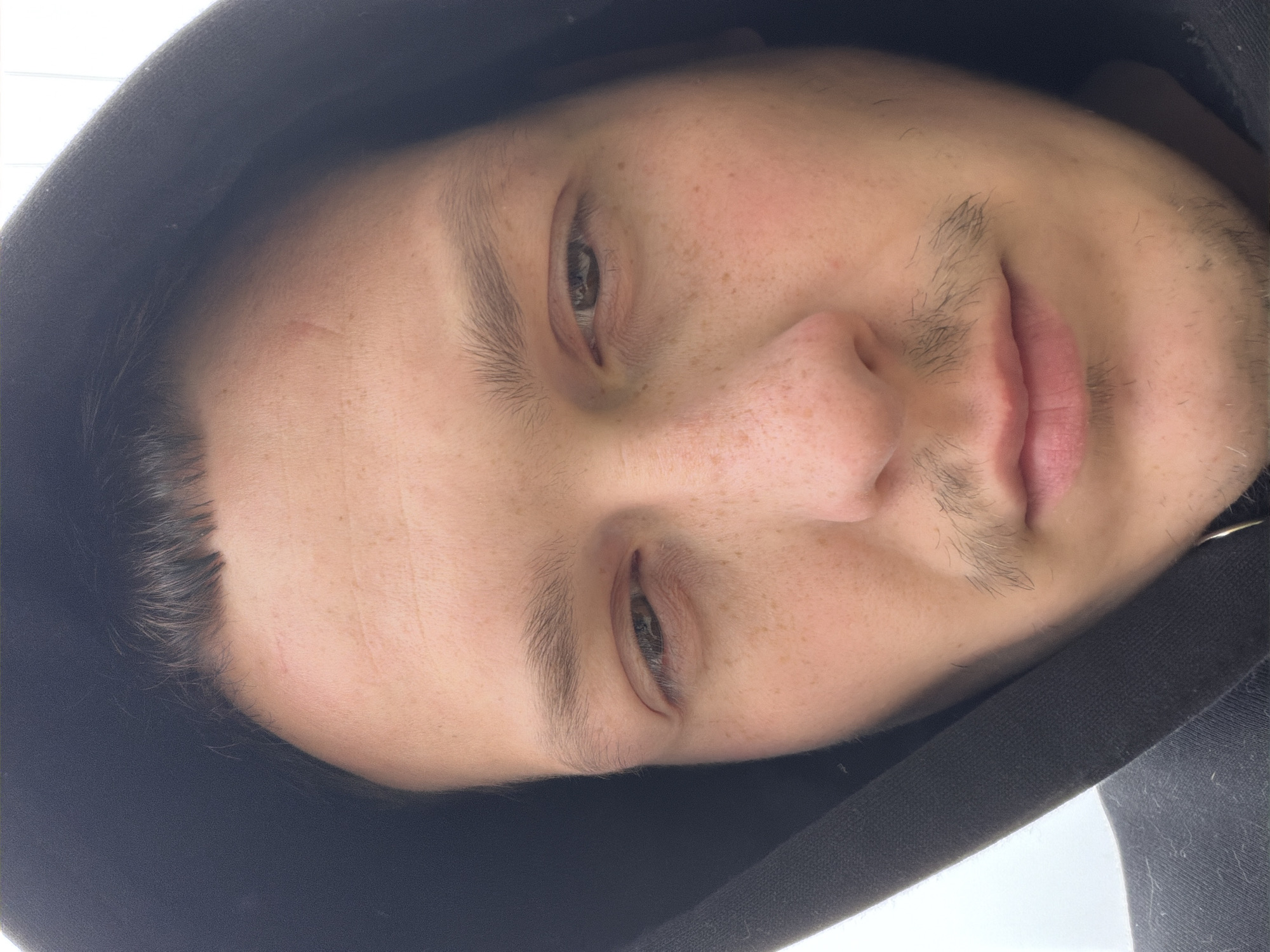 This media file is a close-up portrait of a young adult male, shown rotated approximately 90 degrees clockwise. The subject's head and upper torso are visible, with the face taking up the majority of the frame. He has fair skin, dotted with numerous freckles across his nose, cheeks, and forehead. His dark hair is short and visible under a dark, possibly black, hooded sweatshirt that frames his face.
His eyes are brown and appear partially open, looking towards the camera. Dark, relatively thick eyebrows are visible above his eyes. The area around his eyes shows some puffiness. A faint, reddish linear mark or scar is present on his forehead, above his left eye (viewer's left). He has light, sparse stubble around his mouth and chin, and on his upper lip. His lips are full and have a natural pinkish hue, appearing slightly parted. His nose is prominent, also covered in freckles.
The lighting is soft and even, suggesting either an indoor setting with natural light or an overcast outdoor environment. The background is a bright, indistinct area, hinting at an out-of-focus wall or sky. The overall expression on his face is neutral, perhaps relaxed or slightly contemplative. There is no visible text in the image. The location context provided is Chaikovsky, Russia.