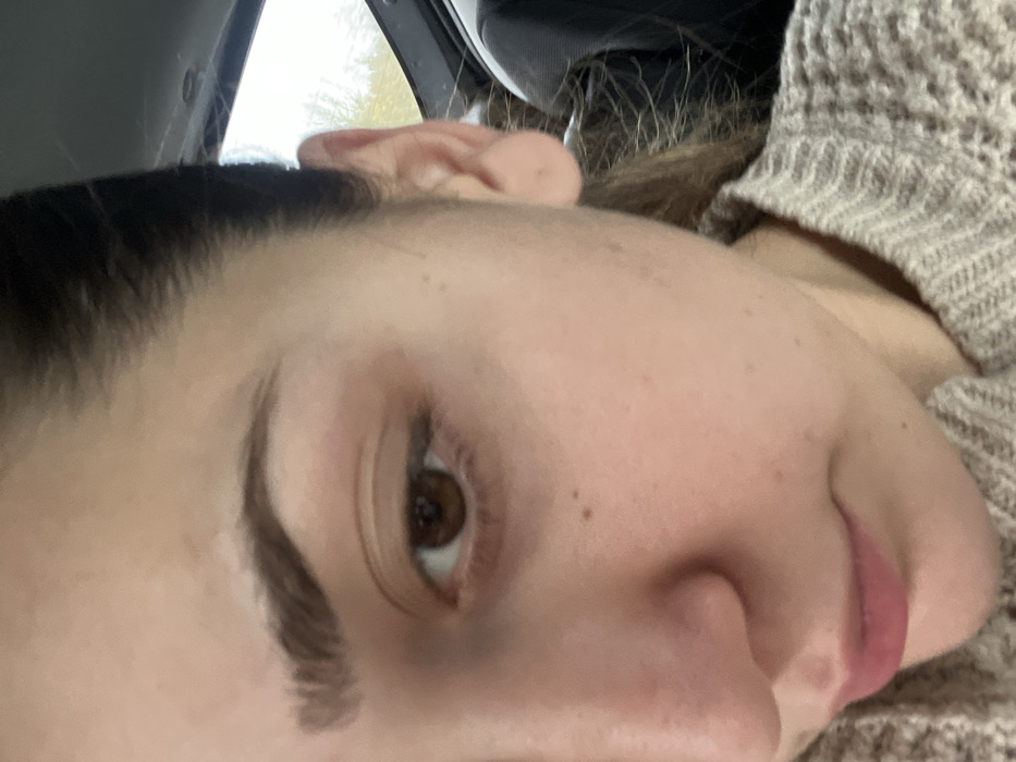 The image presents a close-up, forensically detailed view of the right side of a female individual's face, taken from within a vehicle in Ancenis, France. The subject possesses a fair complexion, with visible pores and multiple small moles or freckles present on the cheek and beneath the right eye. Her dark brown hair is pulled back, revealing the hairline and the entire right ear. The right eye, with a dark brown iris and visible pupil, is open and centrally positioned in the upper portion of the frame. The right eyebrow is dark and appears well-defined. A segment of the subject's nose and the lower lip are discernible towards the bottom-left. The individual is dressed in a light-colored, likely beige, knitted sweater featuring a distinct textured pattern. The immediate background reveals elements of a vehicle's interior, specifically a dark headliner and a dark trim piece, through which a blurred view of outdoor foliage and an overcast sky is visible.