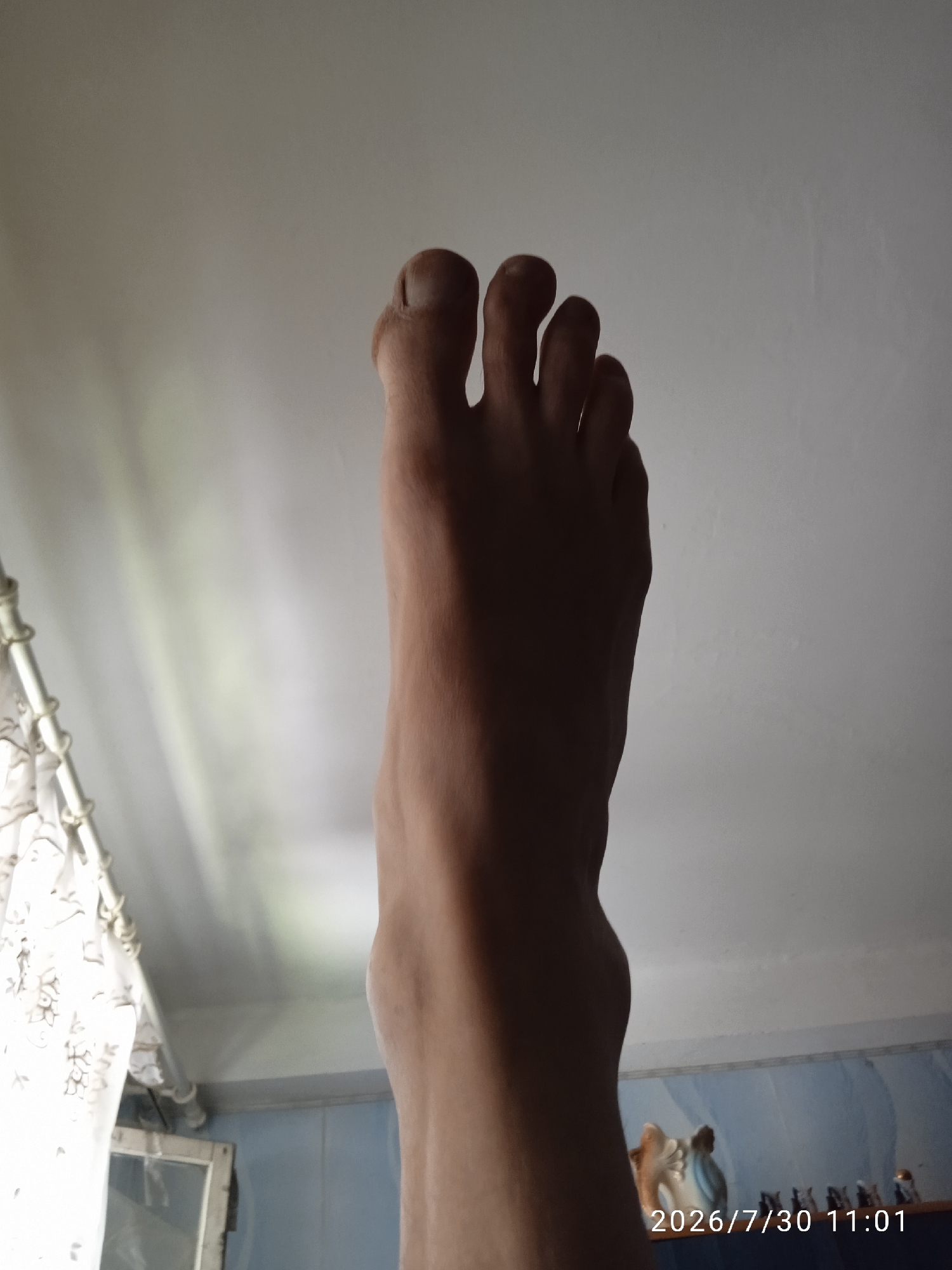 A first-person perspective shot of a bare foot and lower leg is captured, angled upwards towards a white ceiling. The foot is positioned with the toes pointing towards the top of the frame. The lighting creates a dramatic contrast, with the foot and lower leg mostly in shadow, while the ceiling and a section of the wall to the left are brightly illuminated. To the left of the frame, a section of white patterned curtain is visible, partially obscuring a metal rod and what appears to be a window. The background shows a blue tiled wall with a shelf holding several small figurines and what looks like a framed object with a white border. The timestamp "2026/7/30 11:01" is visible in the bottom right corner of the image. The scene appears to be indoors, in what could be a bathroom or a room with similar tiled walls and window coverings.