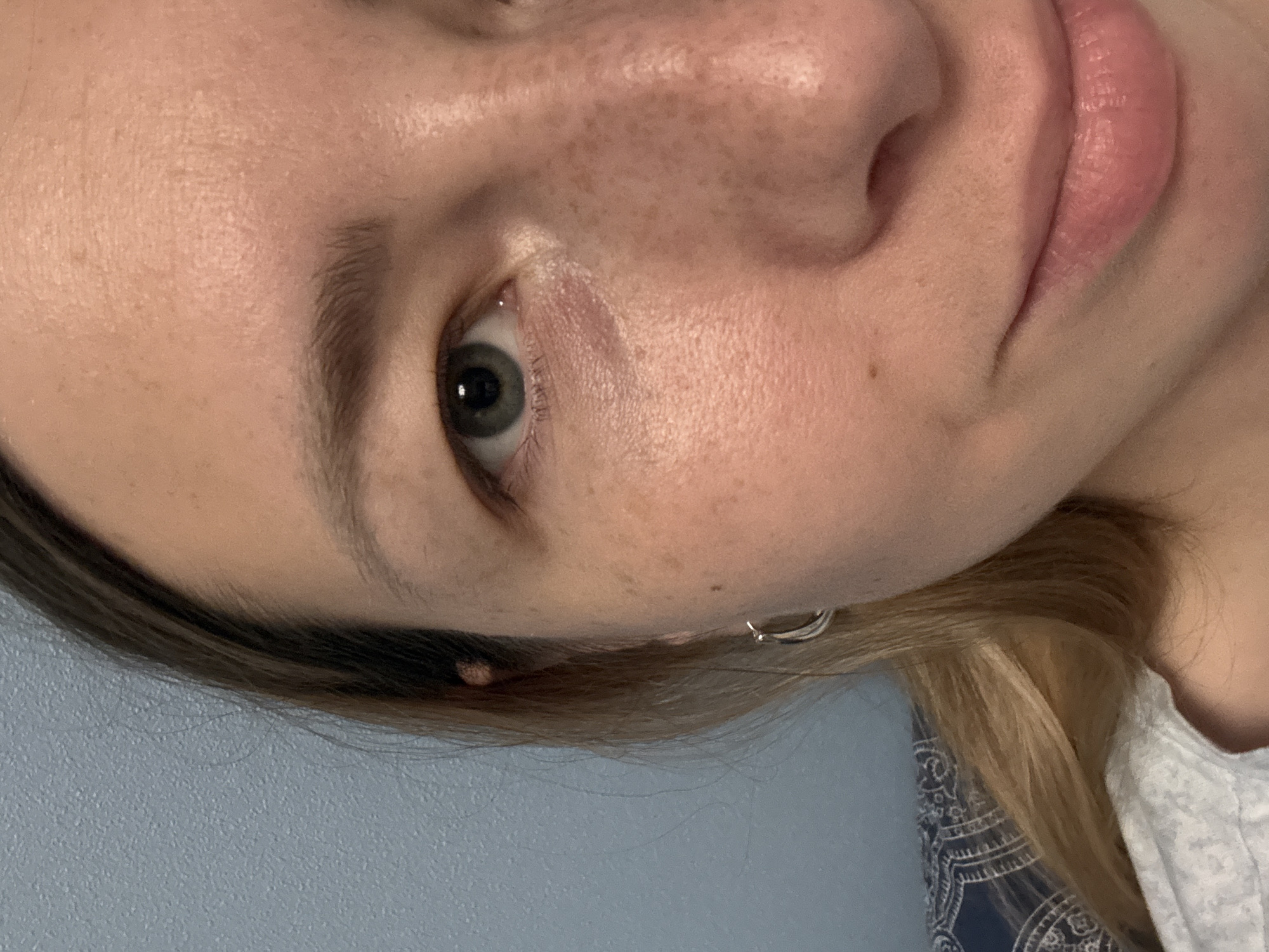 Close-up of a person's face, angled. The person has fair skin with freckles on the nose and cheek. The eye is light green-gray. The lips are full and pink. The person has light brown hair. A silver hoop earring is visible. A mole is located near the hairline. The background is light blue.
The location in Moscow, Russia is not possible to determine.