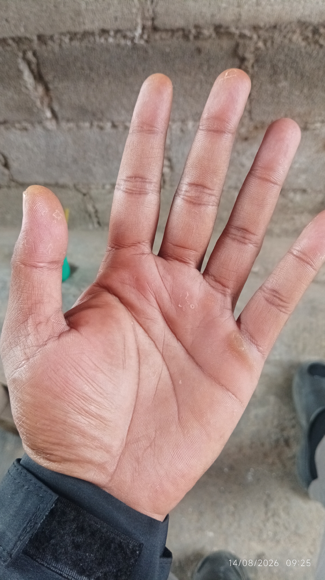 An overhead, medium shot captures the palm and fingers of a person's left hand, held open against a textured, grey brick wall. The hand is positioned at an angle, with the fingers pointing towards the upper right of the frame. The skin on the palm and fingers appears dry and slightly rough, with visible lines and creases. There are small, light-colored dry patches on the palm and the tips of some fingers, suggesting possible dryness or calluses. A dark fabric, possibly part of a garment sleeve with Velcro, is visible along the bottom left edge of the frame. In the background, the brick wall is rough and weathered. To the right of the hand, a blurred image of a grey shoe or sandal is partially visible. The timestamp "14/08/2026 09:25" is present in the bottom right corner of the image. The overall scene is devoid of specific urban identifiers that would pinpoint its location in Tasikmalaya, Indonesia.