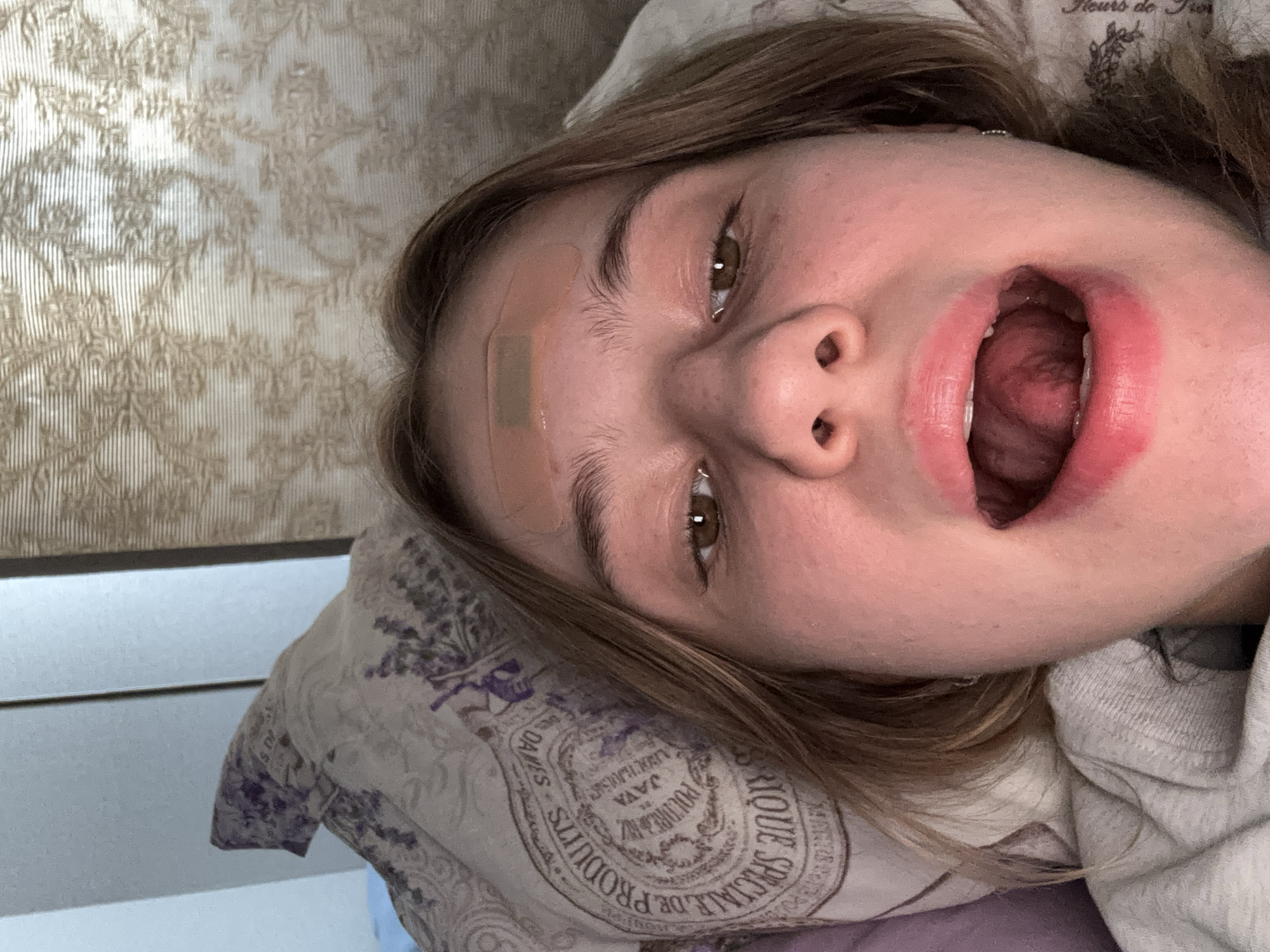 The image is a close-up, first-person perspective of a young woman lying in bed. She has a bandage on her forehead. Her mouth is open, revealing her tongue and the back of her throat. Her eyes are open and looking towards the camera. The background shows a pillow with a floral pattern and a textured wallpaper. The scene appears to be indoors. There is no information available to place this image in Lednevo, Russia.
