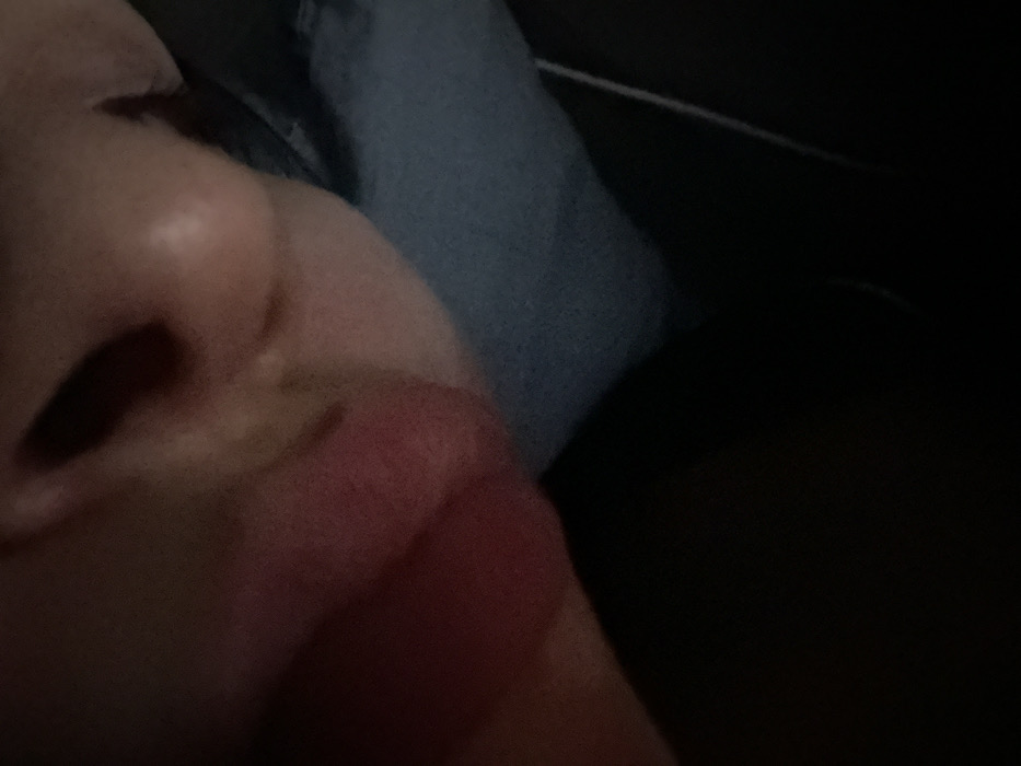 A close-up, poorly lit image shows a person's nose, lips, and part of their cheek. The skin appears smooth. A section of denim fabric can be seen in the background above and to the right of the face. The rest of the background is predominantly black.