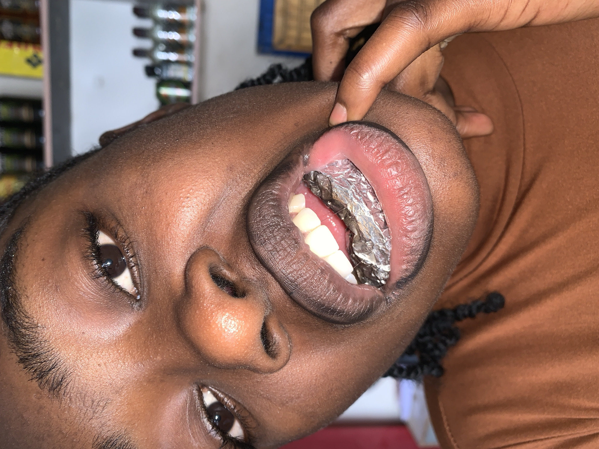 A close-up portrait captures an individual with a dark complexion, their head and upper torso angled towards the viewer. The person's mouth is open widely, revealing upper and lower anterior teeth, behind which a crumpled, reflective, metallic object, consistent in appearance with aluminum foil, is positioned. The subject's right index finger is actively pulling down their lower lip, further exposing the mouth's interior and the metallic item. Dark brown eyes are directed towards the upper left portion of the frame, with visible eyelashes. Dark, braided hair is visible near the left side of the subject's neck. A plain, rust-brown or dark orange garment covers the upper body. The background is significantly out of focus, depicting an indoor setting with multiple shelves holding various bottles, suggestive of a commercial establishment or a well-stocked area. The scene is located in New Stadium, Nigeria.