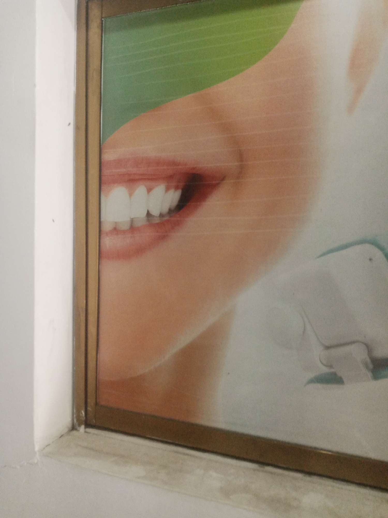 The image shows a close-up of a poster advertising dental services, featuring a woman's smiling mouth with white teeth. The poster is framed in a metallic border and appears to be displayed on a wall. To the left of the poster, a white wall with a slight texture is visible. A light-colored ledge or shelf runs along the bottom of the frame. The overall lighting suggests an indoor setting. The poster's content and the presence of a white wall and ledge are consistent with a commercial establishment, such as a dental clinic, potentially located in Santa Ana, Venezuela.