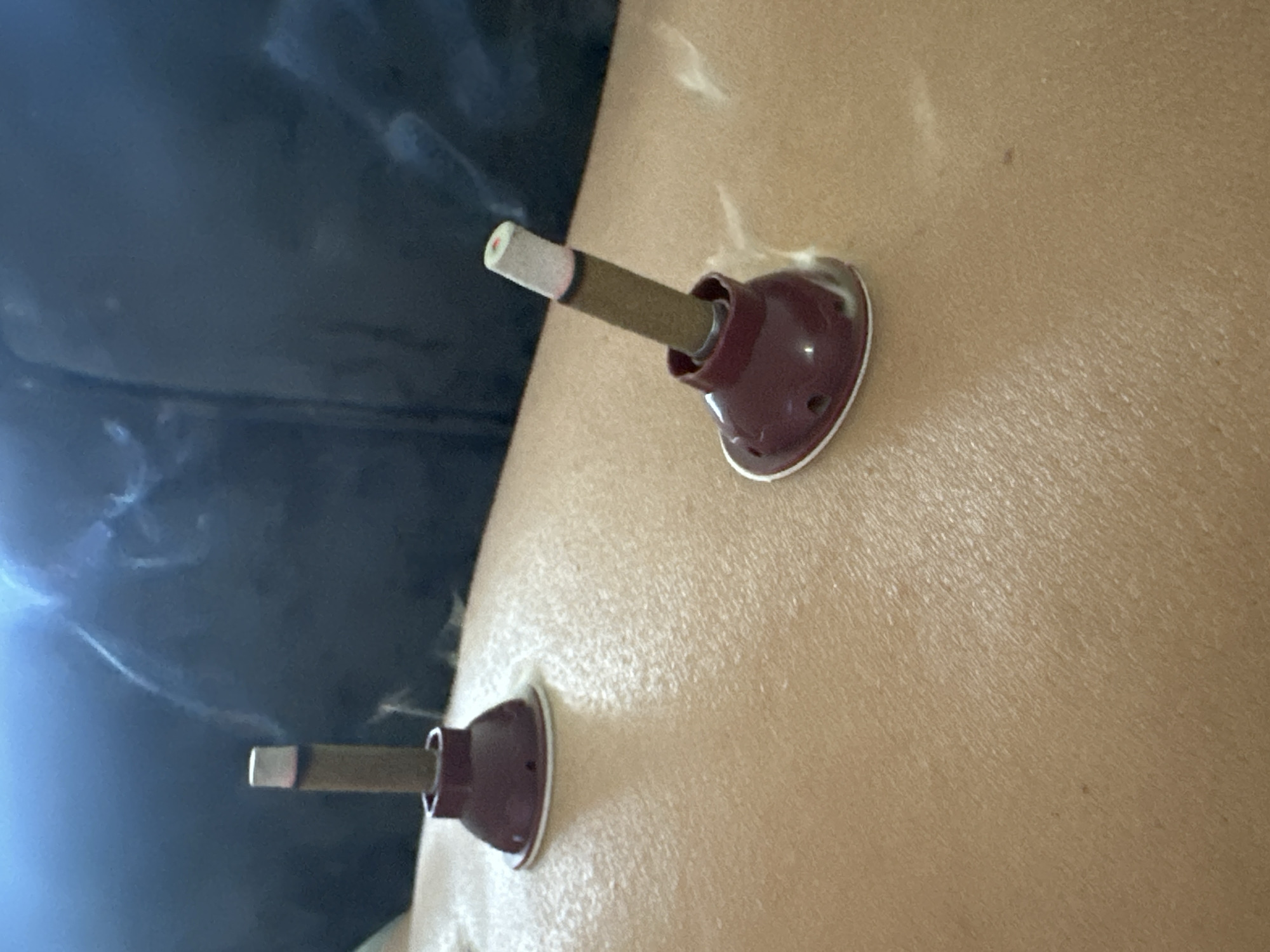 Two cylindrical moxa sticks are burning inside maroon-colored holders attached to a person's light-colored skin. The holders are round and have a suction-cup-like base. Smoke is rising from the burning sticks. The location in the city of Kharnavy, Russia, is not discernible from the image.