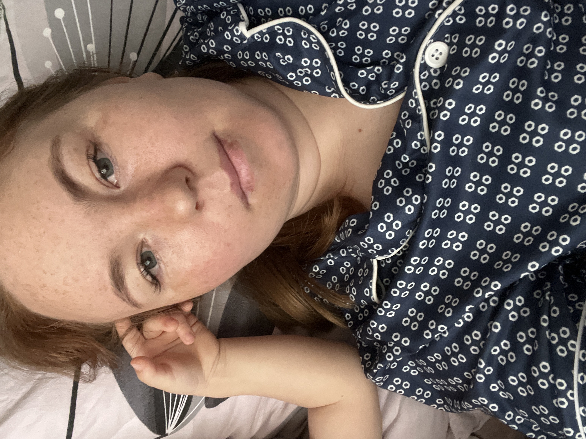 A fair-skinned woman with freckles and auburn hair is lying on her back in bed. She is wearing a blue and white patterned pajama top with white piping around the collar and a button closure. The background consists of a gray and white striped pillowcase and a white sheet. The woman's face is turned slightly towards the camera. Her eyes are open and directed towards the viewer. Her right hand is raised near her face, with her fingers slightly curled. The scene is indoors. The location appears to be residential and based on the information provided, might be a home in Chaikovsky, Russia.