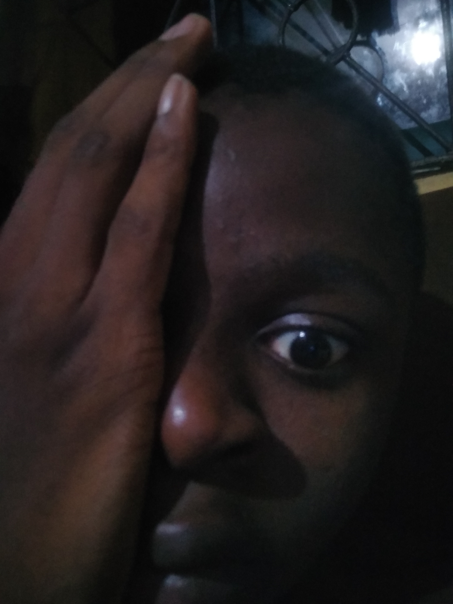A close-up image depicts a person with dark skin tone. One eye is visible, and a hand is positioned over part of the face, casting a shadow. A window with metal bars is visible in the upper right corner, with an out-of-focus light source visible outside. The location is Unknown, Unknown.