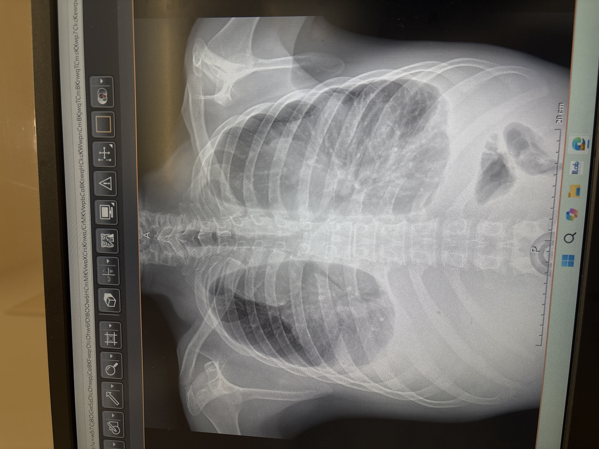 This image shows a frontal chest X-ray displayed on a digital screen. The ribs, spine, and shoulder bones are visible. The lung fields are darker in the middle compared to the edges, which is to be expected. There are several imaging tools visible on the side of the screen. Also displayed on the screen are icons for File Explorer, Windows, and some lab applications. The location of Puebla, Mexico is not discernible from this image.