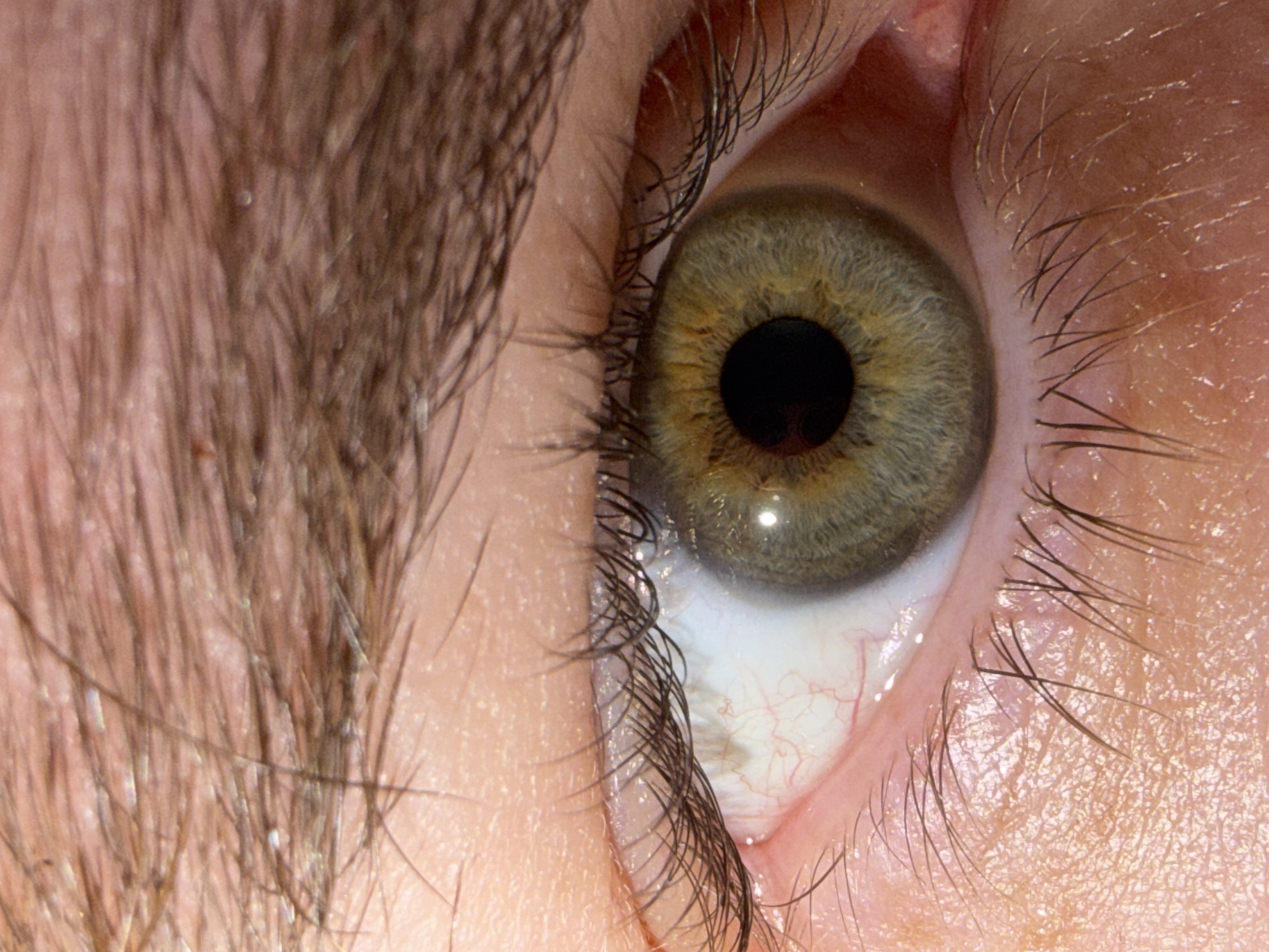 Close-up photograph of a human eye, exhibiting a dark pupil surrounded by a hazel/green iris. Eyelashes are visible on the upper and lower lids. The sclera appears white with prominent blood vessels. Portions of the eyebrow are visible on the left side. No information in the image suggests a location in the city of Chaikovsky, Russia.