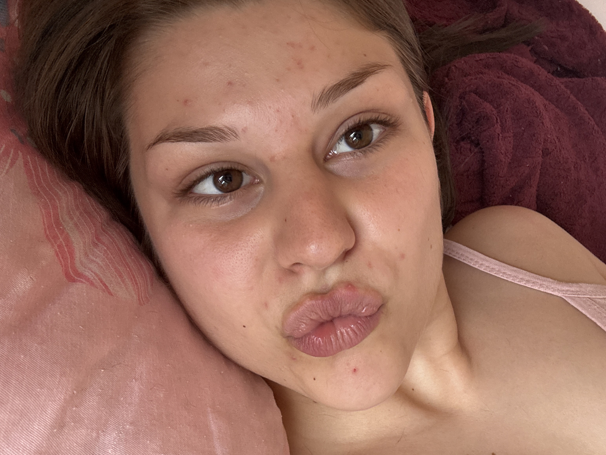 The media file is a close-up selfie of a young person lying down, with their head resting on a pink pillow. The person has medium-brown hair and brown eyes, with their lips pursed. Their skin has some visible blemishes and redness, particularly on the forehead and chin. The person is wearing a pink strap, suggesting they are wearing a camisole or tank top. Behind the person, a dark red, textured fabric, possibly a blanket or towel, is visible. The lighting suggests it could be daytime, with natural light illuminating the subject's face. The overall mood appears relaxed and casual, typical of a personal selfie. There is no visible text in the media file.