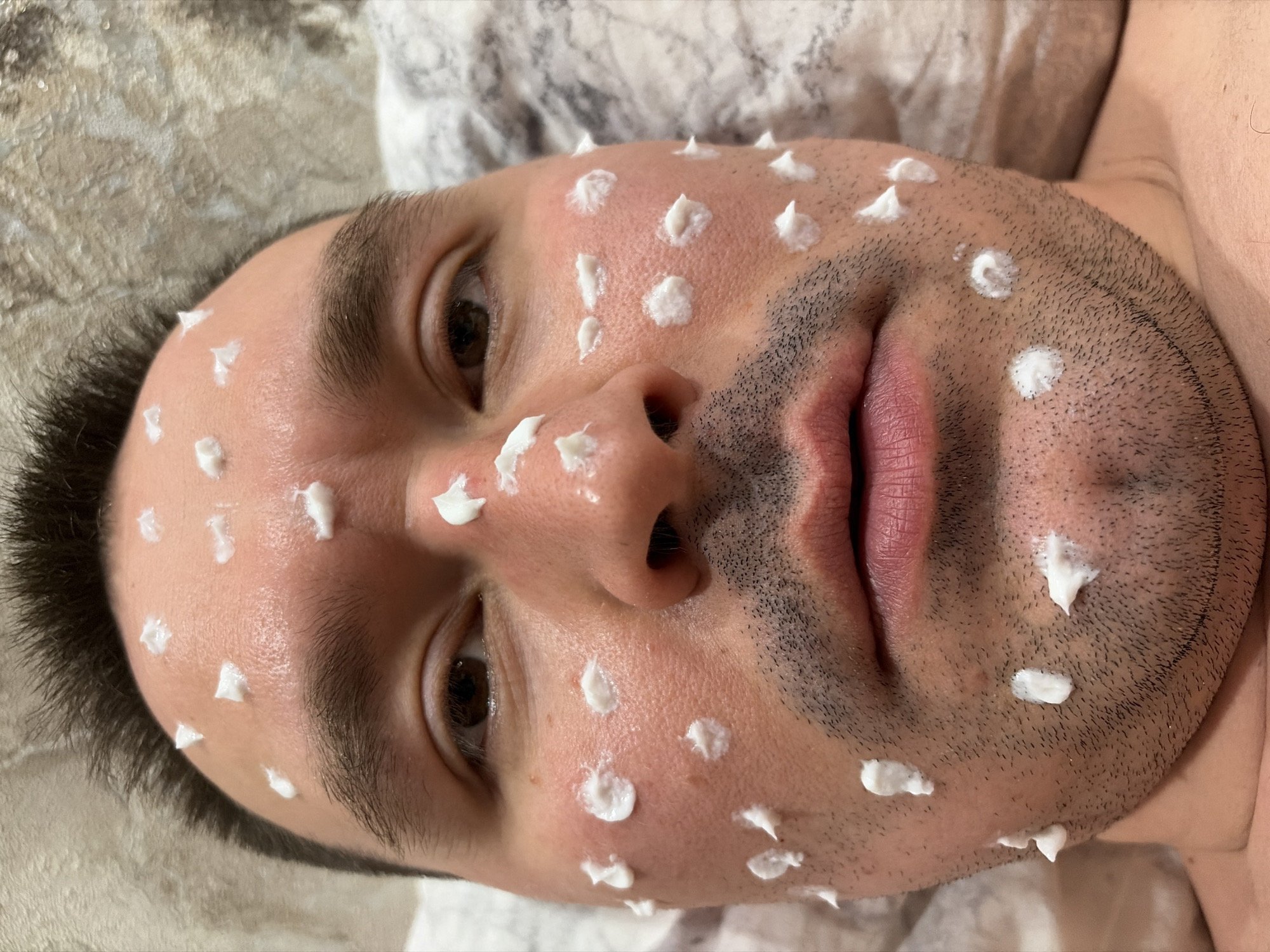 A close-up, angled view shows a man lying down with white cream spots applied to his face. His face occupies the majority of the frame. He has dark hair, brown eyes, and stubble. The background consists of a mottled, light-colored surface. The subject's right shoulder is visible in the upper right of the frame. There is no contextual information to identify this location as Izhevsk, Russia or any other specific location.