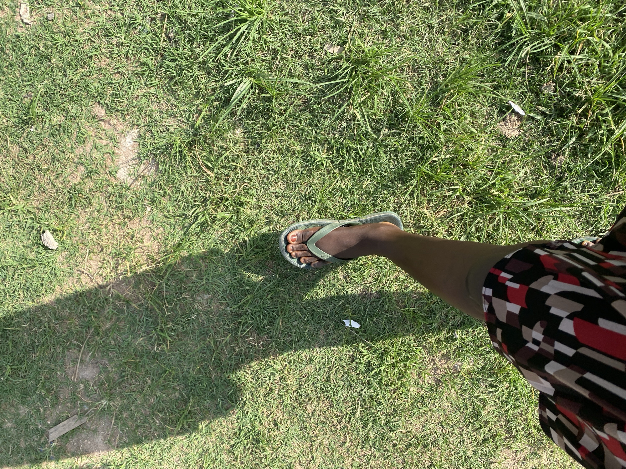 A person's left leg, from the knee down, is visible, wearing a patterned skirt and a green flip-flop. The leg is positioned on a grassy area, with a shadow cast across the grass, indicating a sunny day. The environment appears to be outdoors, possibly a park or residential area, in Jauro Yinu, Nigeria. There is a small piece of white paper on the grass.