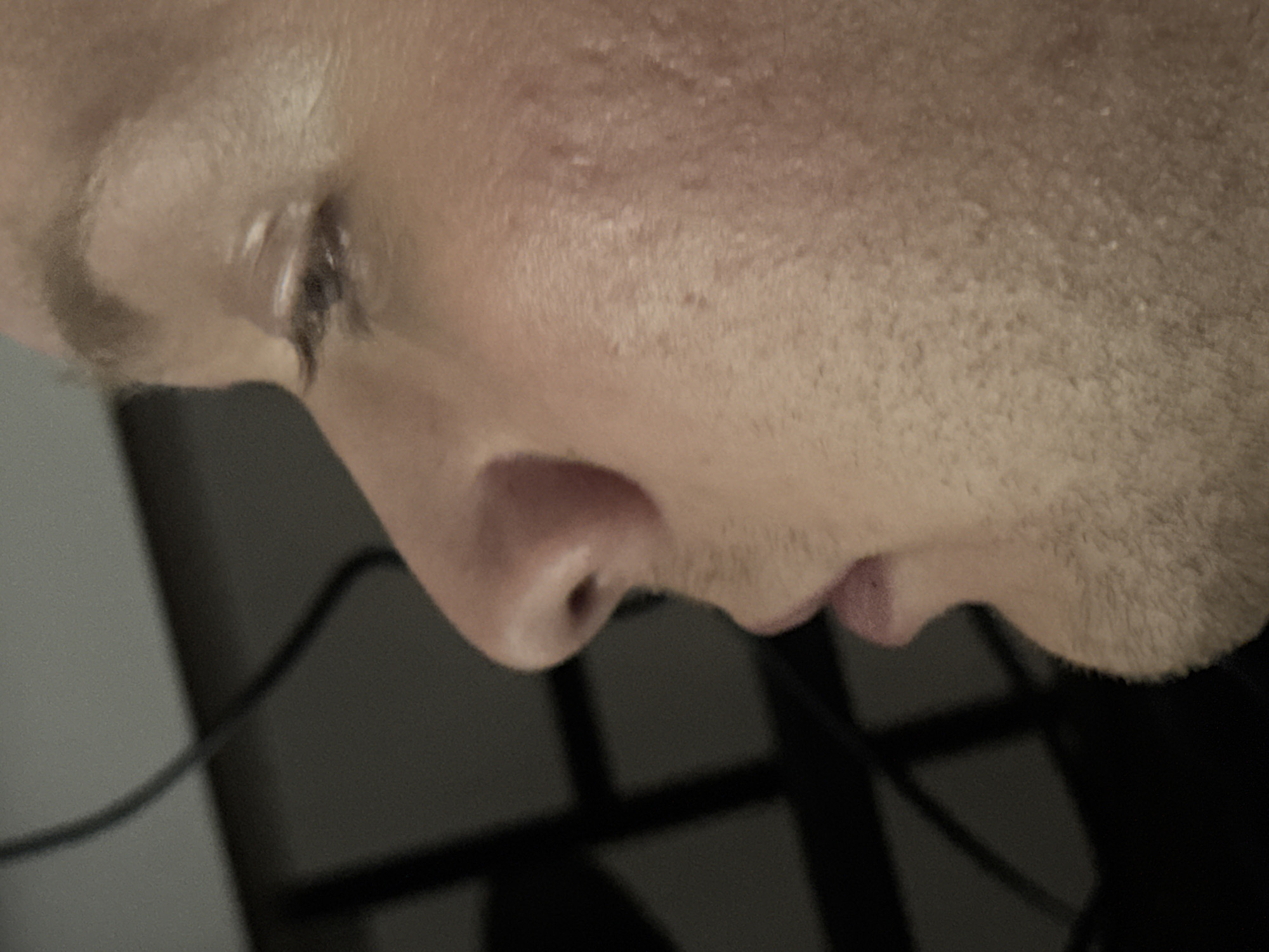 The image is a close-up, side profile of a person's face, focusing on the right eye, nose, and mouth. The skin appears to have some texture and minor blemishes. The background is dark and out of focus, with some geometric shapes visible, possibly from a window or furniture. There is no discernible location in Saratov, Russia, or any other specific city. The subject is not engaged in any action, nor are there any interactions depicted. The scene is static and provides no environmental context beyond the immediate facial features.
