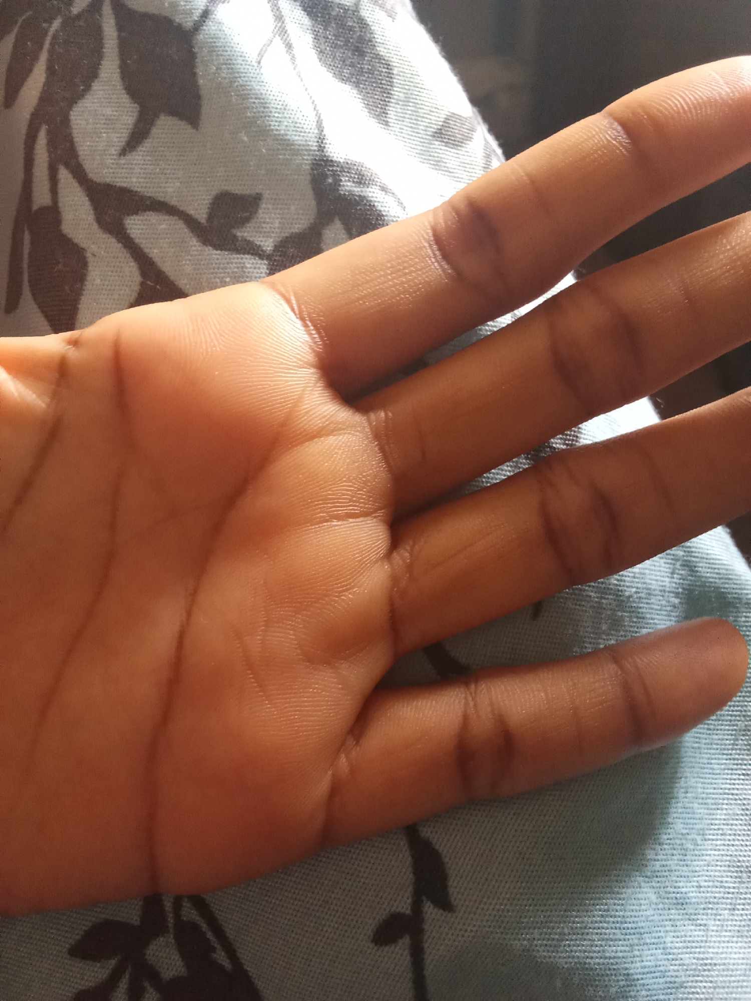 The image shows a close-up view of a person's open hand, palm up, resting on a patterned fabric. The fabric appears to be light blue with a dark, abstract floral or leaf design. The hand is lightly tanned, and the skin shows fine lines and textures, particularly on the palm and fingers. There are faint dark marks or shadows on two of the fingers. The lighting suggests an indoor setting, possibly with natural light coming from the side, casting soft highlights on the hand. The overall tone of the image is calm and still. No activity or event is clearly depicted, and the focus is solely on the hand and the immediate background. There is no visible text in the image.