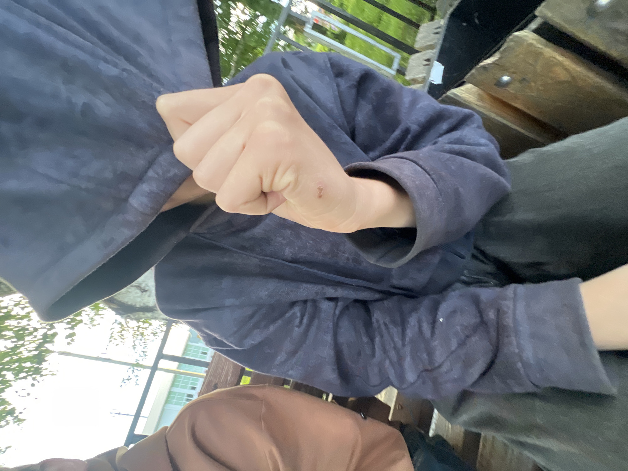 The image shows a first-person perspective of a person, likely young, sitting outdoors on what appears to be a wooden bench. The subject is wearing a dark blue hooded sweatshirt and dark pants. Their right hand, with knuckles prominent, is held up in front of the camera, showing a small scab on the back of the hand. The background suggests an outdoor setting with greenery and sunlight filtering through trees, indicating daytime. In the distance, a building with multiple windows is visible. The scene is casual and appears to be a relaxed moment. There is no visible text in the image. The context of "Перевозное, Russia" suggests a geographical location, but there are no specific visual cues in the image to confirm this.