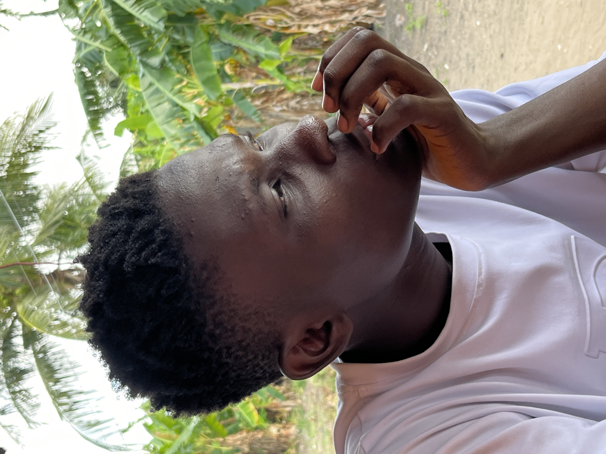 A young, dark-skinned man is shown in an outdoor setting. He is wearing a white T-shirt. His head is turned to the right, with his fingers near his mouth. The background shows green foliage, suggesting a tropical environment. The location is Badagry, Nigeria.