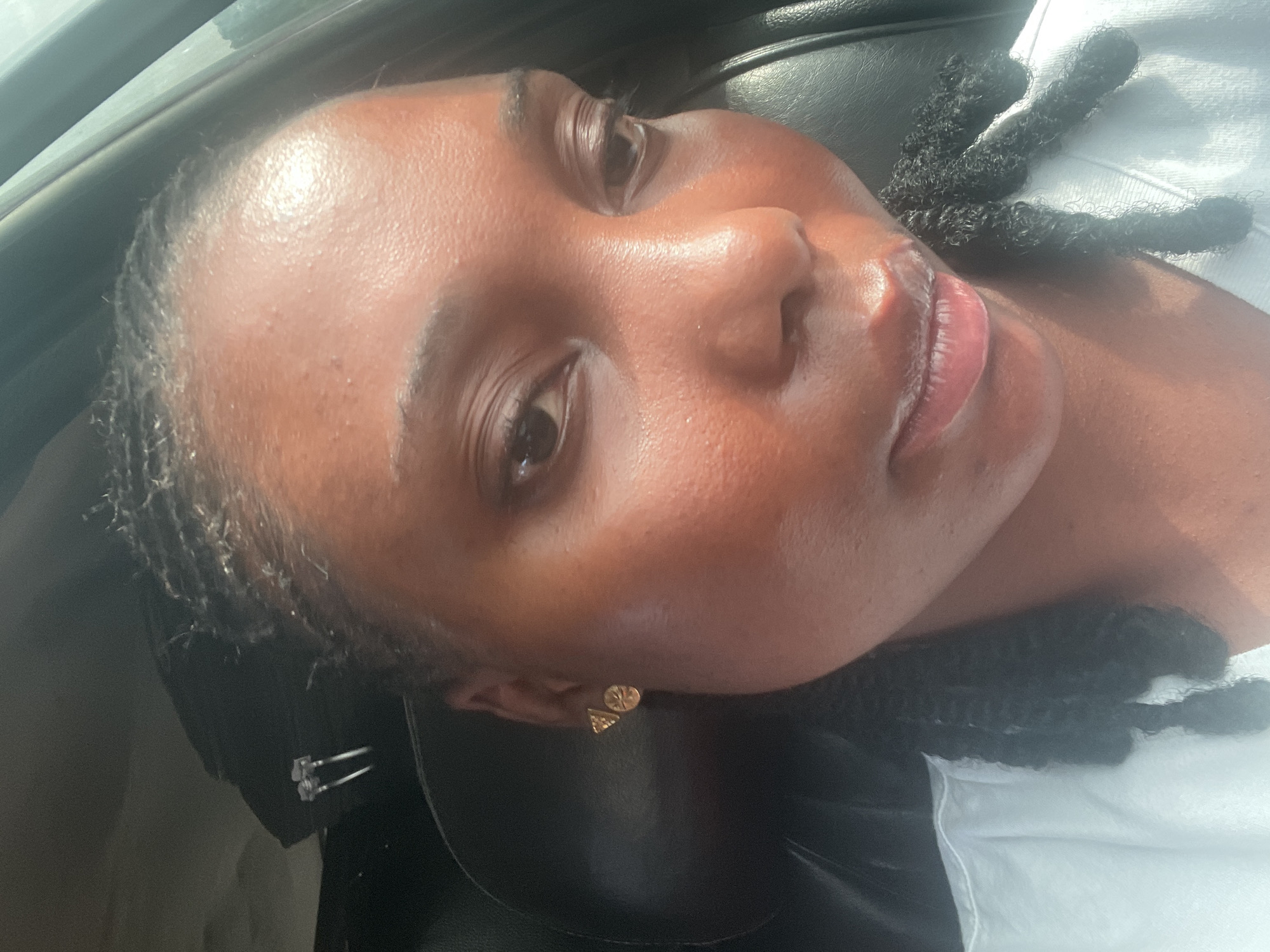 A medium close-up, high-angle portrait features a person with dark skin lying down, likely in a car, under bright, direct sunlight. The image is rotated, showing the person's head tilted with their face looking upwards.
The subject has a neutral, relaxed expression with open, dark brown eyes. Their dark hair is styled in numerous small braids or twists, visible around the hairline and extending towards the bottom right of the frame. Strong, direct sunlight illuminates the face, creating noticeable highlights on the forehead, cheekbones, and slightly parted, full lips. The lips have a natural pinkish-brown color with a glossy finish. The skin displays visible texture and pores, with a few small bumps on the forehead and cheeks.
On the visible right earlobe, two small gold stud earrings are present: one circular with a discernible pattern, and the other triangular.
The background suggests the interior of a vehicle, with a dark car seat and a window frame visible. A white surface, likely the person's clothing (a white top), is visible on the right side, underneath some of the braided hair. The scene evokes a moment of rest or travel during a sunny daytime in Akwanga, Nigeria. No text is visible in the image.