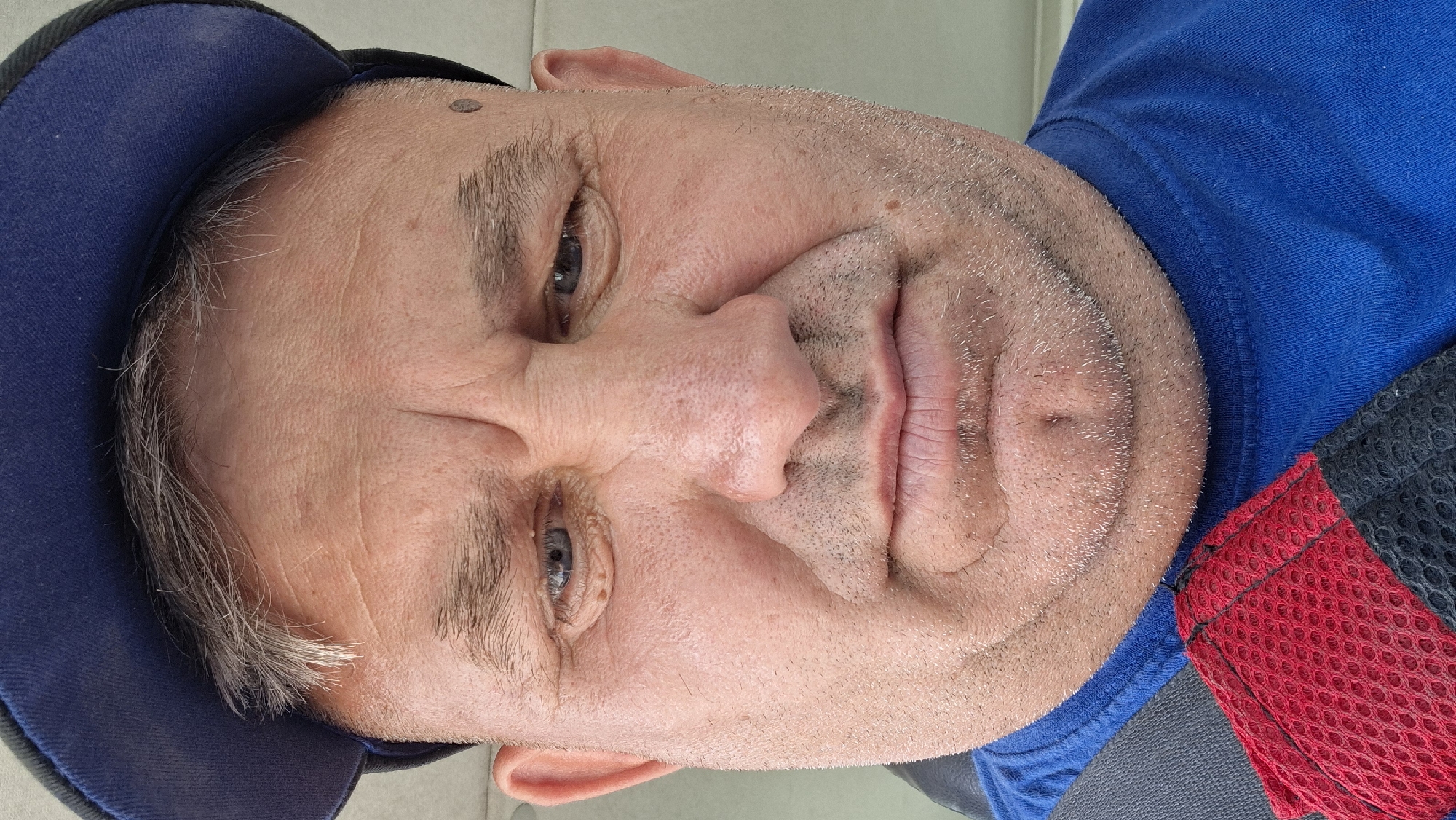 A close-up, low-angle, outdoor, selfie-style photograph shows a middle-aged Caucasian man's face, from the forehead down to his chest. The man is wearing a blue baseball cap and a blue t-shirt. A red and black mesh strap is visible across his chest. The man's expression appears to be a mix of concern and weariness, with furrowed brows and downturned lips. His skin is fair and shows signs of aging, with wrinkles on his forehead and around his eyes. He has a mole on his forehead above his right eye. The lighting is natural and appears to be from a slightly overhead source, casting soft shadows. The background is out of focus and suggests an outdoor urban environment, possibly within the city of Hîncești, Moldova, though no specific landmarks are identifiable.