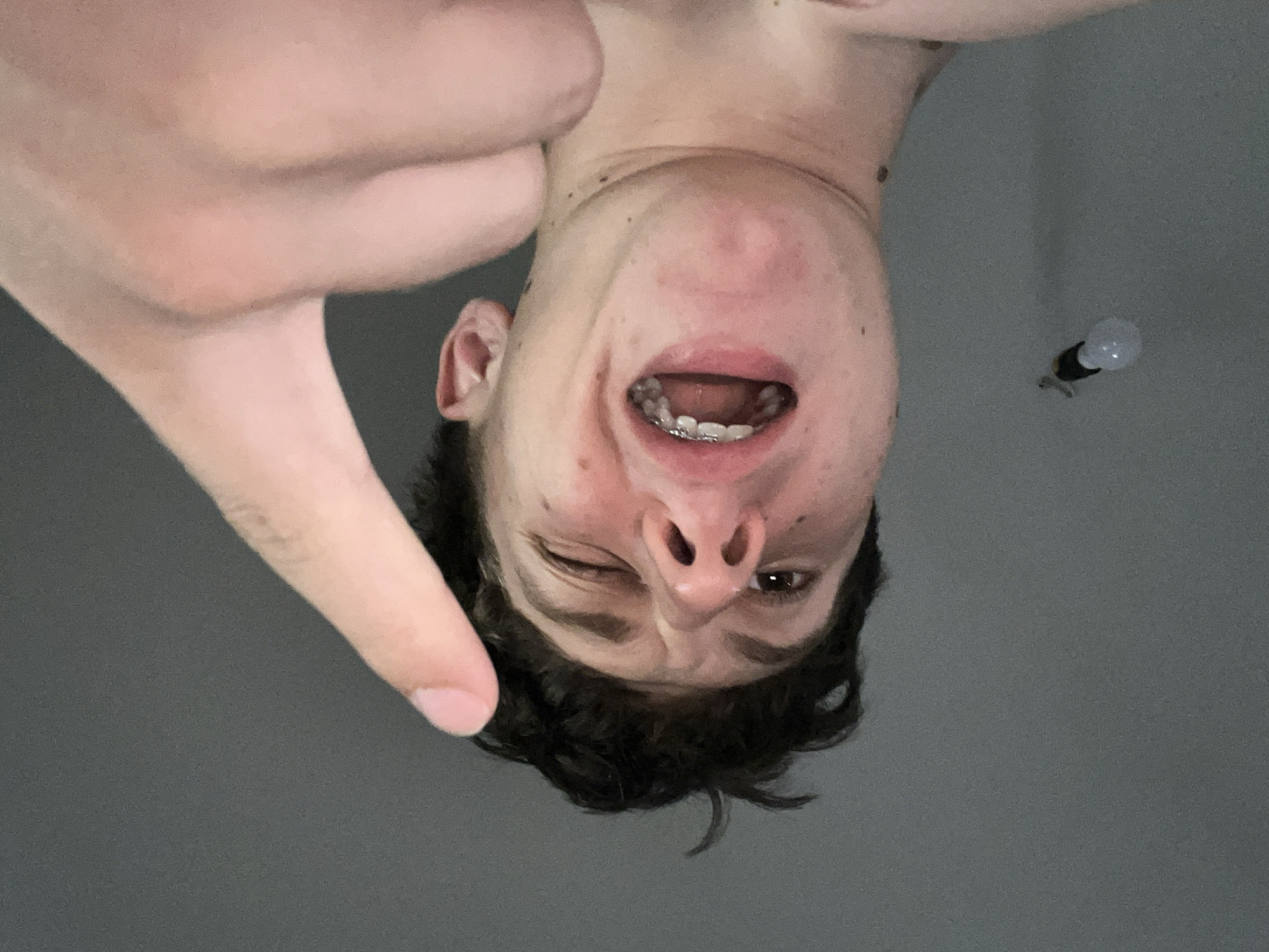 This is a close-up, upside-down, eye-level, medium shot of a young person's face against a plain, gray background. The person is looking directly into the camera, with their mouth open and teeth visible, some of which appear to have braces. Their left eye is partially closed, giving a winking or squinting appearance, while the right eye is open and looking forward. Their skin is fair with some visible pores and scattered dark spots. They have dark, curly hair. A portion of their left hand is visible in the upper left quadrant of the image, with the thumb pointing downwards towards the face. In the upper right quadrant, a small, clear lightbulb with a visible filament is suspended against the gray background. The lighting appears to be artificial, and there are no discernible clues about the time of day, weather, or specific location. The overall emotion conveyed is one of playfulness or a candid, slightly mischievous expression.