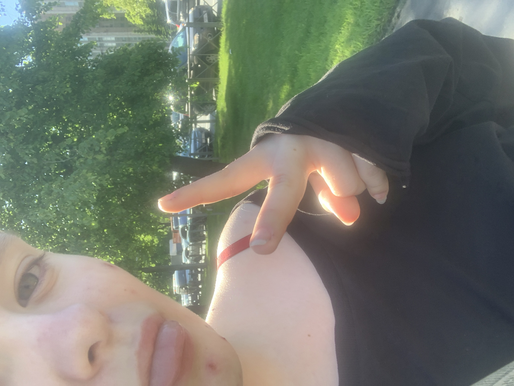 The image is an angled, close-up selfie of a person outdoors on a sunny day. The person's face is visible on the left side, showing one eye, part of their nose, and mouth. They appear to be looking towards the camera.
The primary subject is wearing a black long-sleeved top, and a red strap, possibly from an undergarment or a second layer of clothing, is visible on their upper right arm. Their right hand is raised, fingers forming a "V" shape, commonly known as a peace sign. The sunlight strongly illuminates their hand and arm, creating a bright glow.
The background reveals a vibrant outdoor setting. There is lush green grass and numerous leafy trees, suggesting a park, boulevard, or residential street. Several parked cars are visible behind a fence or railing, lining what appears to be a paved area or road. Buildings can be faintly discerned in the distance, partially obscured by the trees.
The strong sunlight indicates a bright, clear day, likely late morning or afternoon, given the angle of the light and the prominent glints on the cars and the person's skin. The overall atmosphere appears casual and summery. There is no visible text in the image.