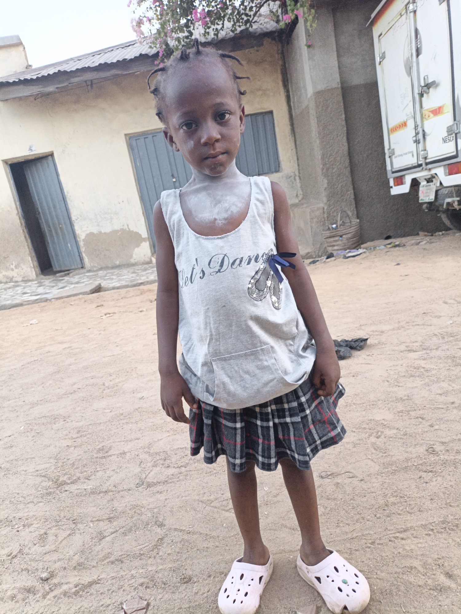 A young child stands outdoors in Gwagwarwa, Nigeria. The child, covered in white powder around the neck, wears a grey sleeveless shirt with "Let's Dance" printed on it, a plaid skirt, and pink Crocs. Behind the child are buildings with corrugated iron roofs and metal doors. A white truck is parked to the right. The ground is dirt and sand. There is a flowering plant visible above the building behind the girl. A woven basket sits near the truck in the background.