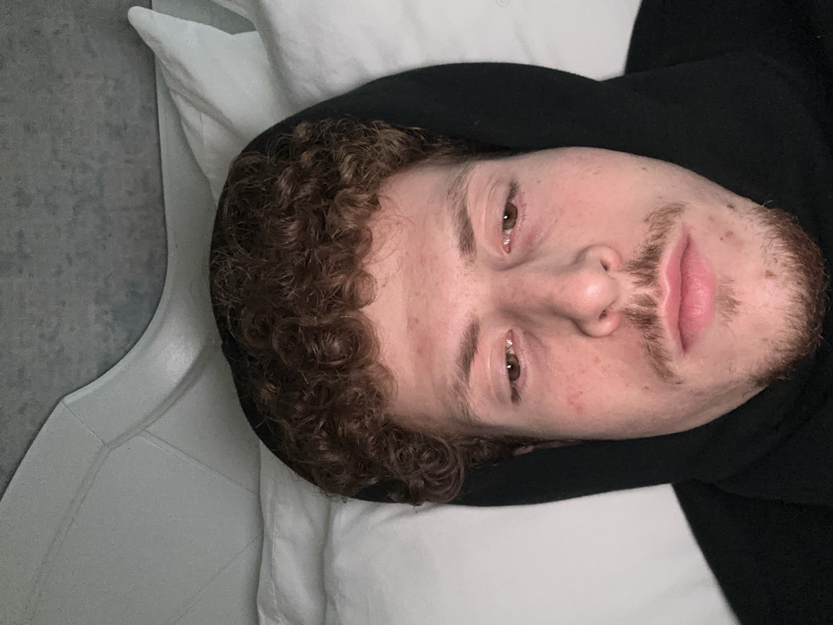 A man with curly brown hair and a patchy beard rests in bed. He is wearing a black hooded sweatshirt. His eyes are open. He appears to be lying on a white pillow on a white bed, with a light gray wall or surface partially visible in the background to the left. He is positioned at an angle to the camera, with his head tilted to the right.