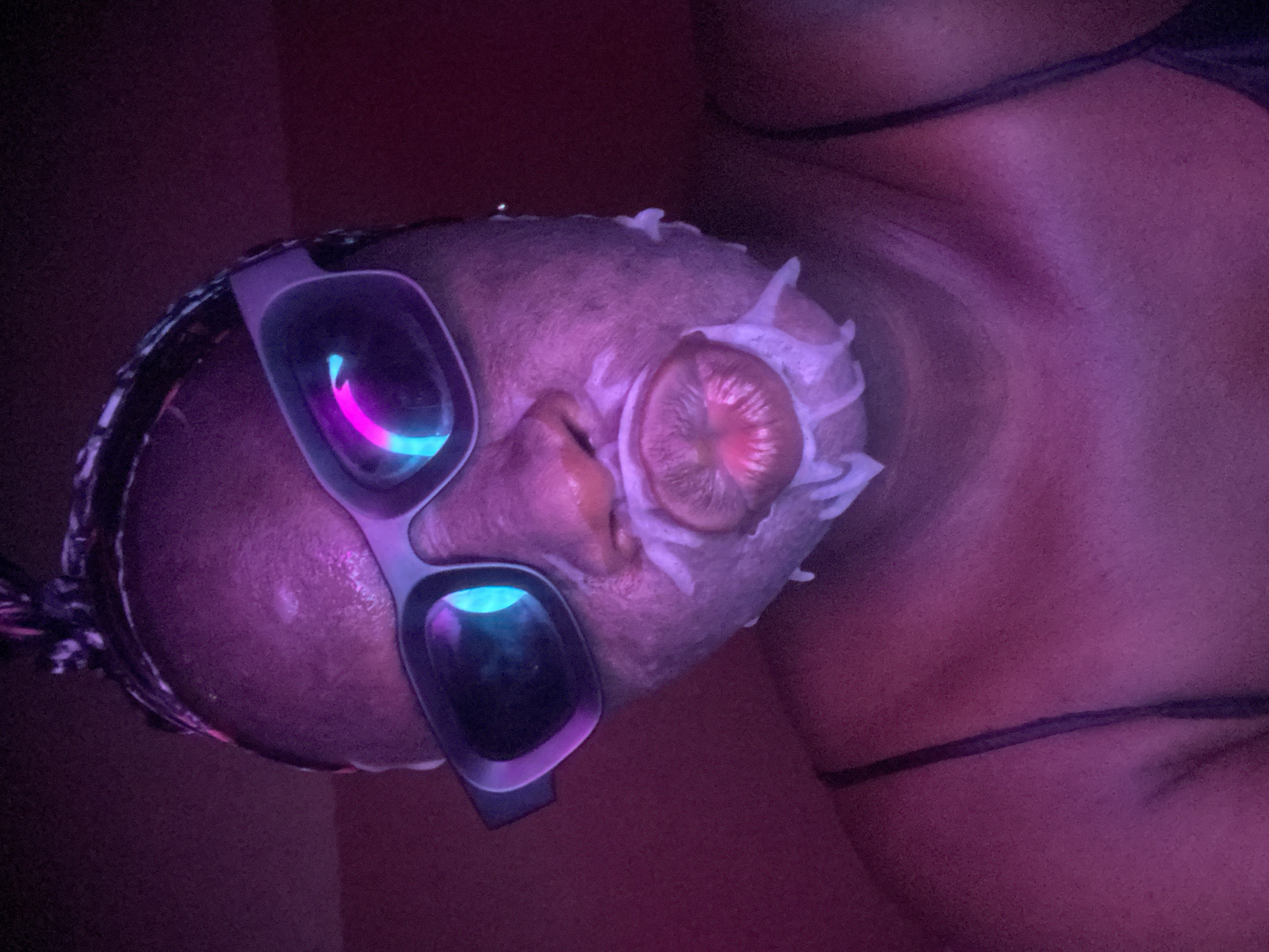 The image captures a person's face and upper chest, illuminated by strong purple and pink ambient lighting. The individual is wearing large, light-colored goggles, the lenses of which brightly reflect neon pink and blue light, suggesting an artificial light source or display. Their face is covered with a white, textured substance, likely a facial mask, indicative of a skincare or spa treatment.
A notable detail is a circular, ridged object with a reddish-pink center placed over the person's left eye, resembling a slice of fruit or a specialized eye treatment pad. Braids are visible along the side of the head, extending from beneath the goggles. Part of a thin, dark strap from an article of clothing, possibly a top or bra, is visible across the upper chest area.
The overall scene suggests a focused activity, likely a beauty or wellness treatment, taking place in a controlled, dimly lit environment, possibly a spa or a home setting with specialized lighting. The artificial illumination makes it impossible to determine the time of day. No visible text is present in the image. The person's expression is not discernible due to the mask and eye covering.