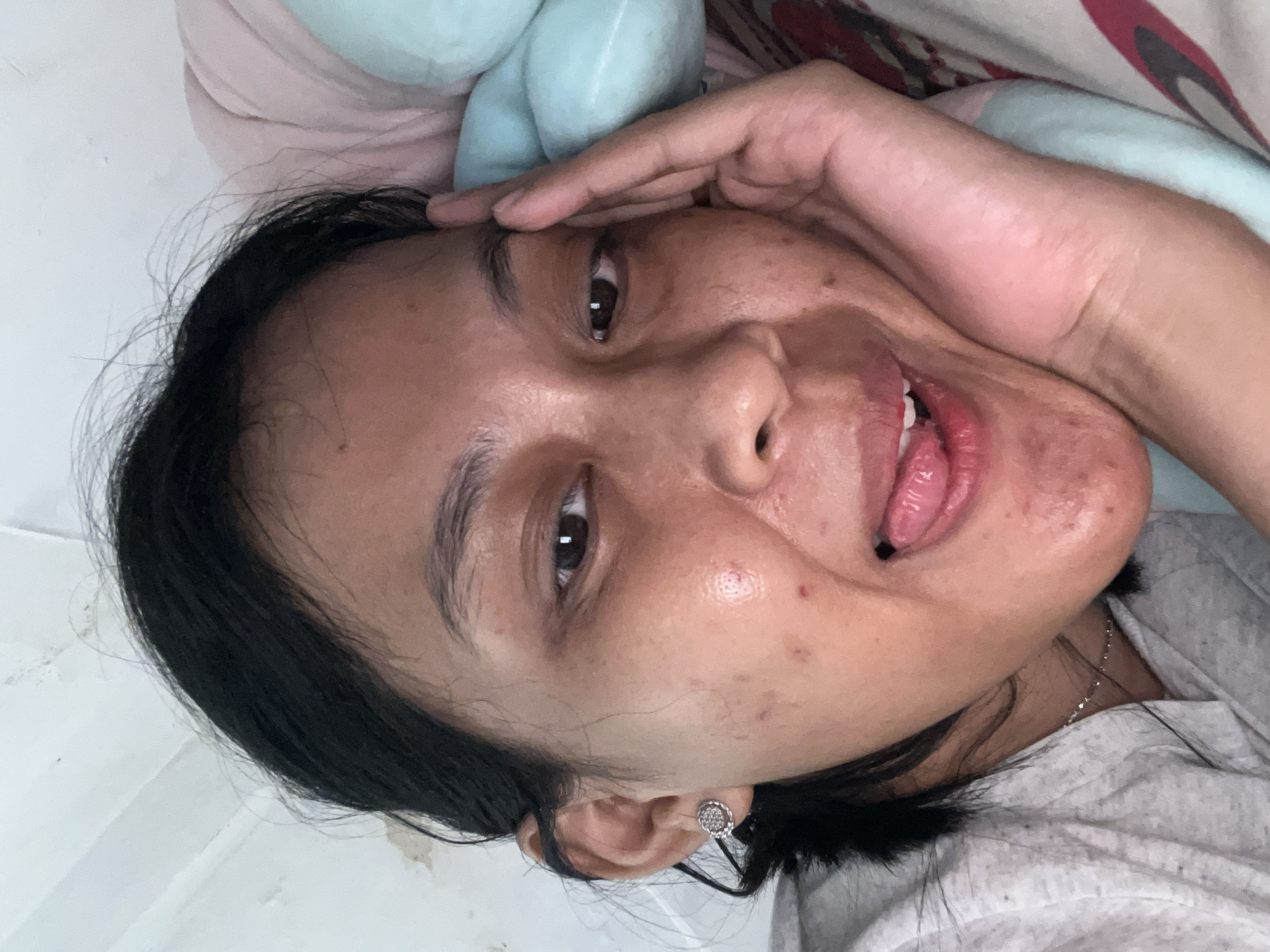 This is a close-up, front-facing selfie of an adult East Asian female. She has dark hair pulled back, revealing her face and left ear. She is wearing a gray t-shirt and a delicate silver necklace. A stud earring with a circular pattern is visible on her left earlobe. Her right hand is resting on her cheek, with her fingers extended towards her forehead. Her mouth is slightly open, with her tongue extended. The background appears to be a bedroom with a white ceiling and a light blue and pink pillow. The lighting suggests an indoor setting, possibly during the day. The image shows some skin imperfections such as acne and blemishes on her face. There are no explicit indicators of the location being in Kecamatan Pati, Indonesia.