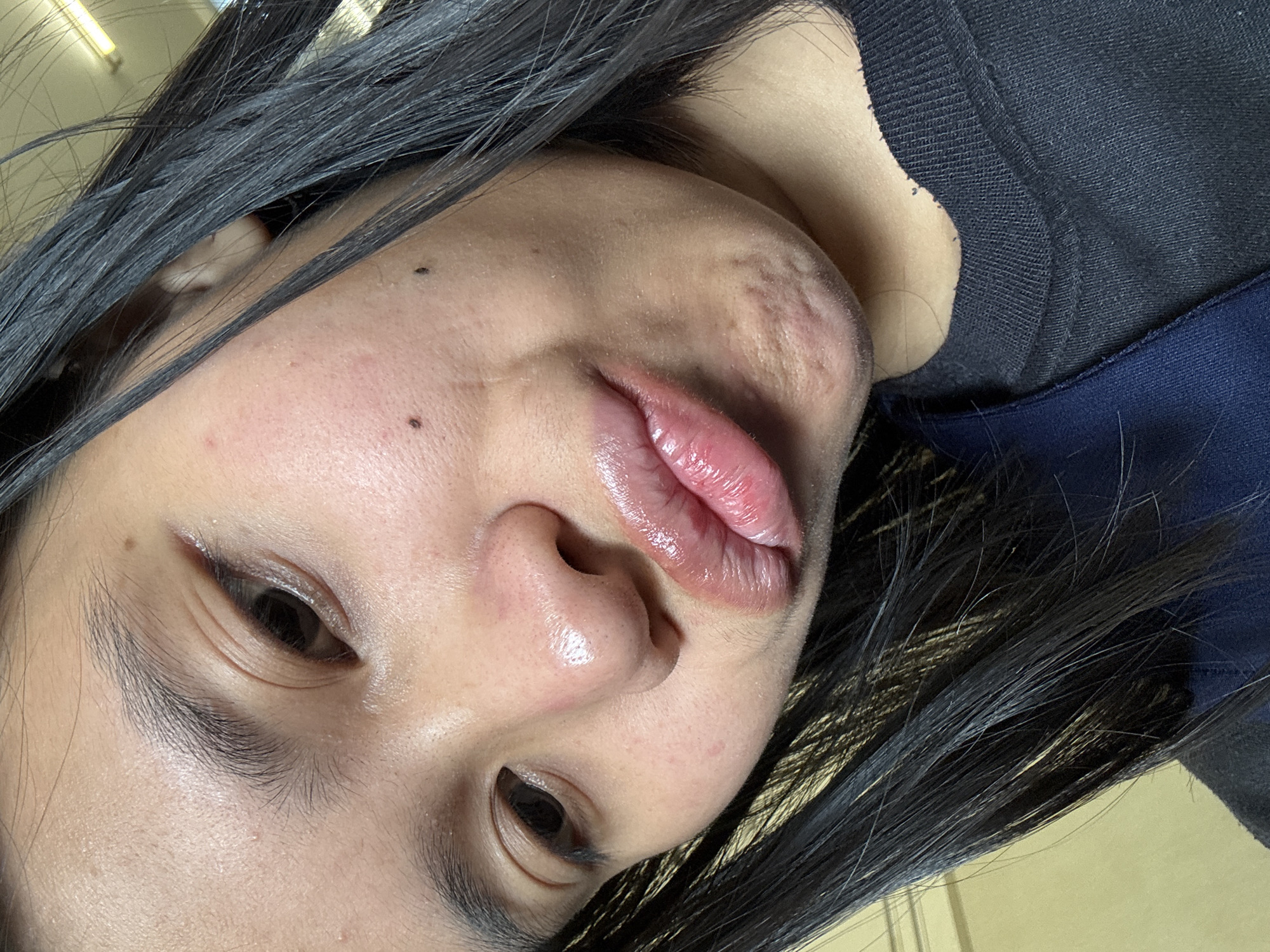 This is a close-up, indoor photograph of a young woman's face. She has dark hair, which is partially obscuring her face. Her skin appears to have some blemishes and texture. She is wearing dark clothing. The lighting suggests an indoor environment, possibly a home or office, but no specific urban details are visible. The image does not provide enough information to determine the location within East Jakarta, Indonesia.