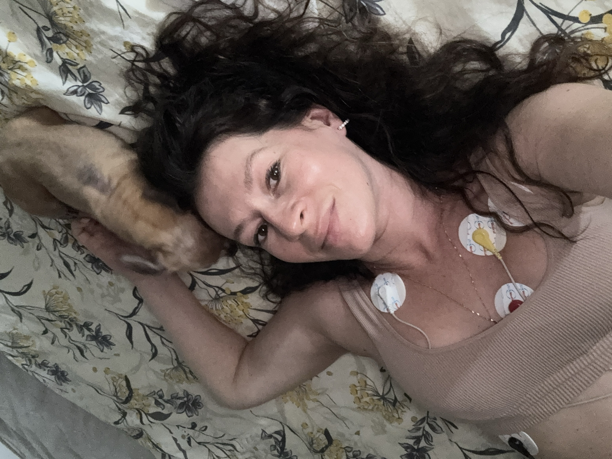 A woman with dark, wavy hair lies on a bed with floral-patterned sheets. She is wearing a light-colored tank top, and several medical sensors are attached to her chest. She is looking at the camera and smiling. Her left arm is resting on the bed. A small dog with tan and brown fur is lying on the bed behind her head. The image was taken in a bedroom.