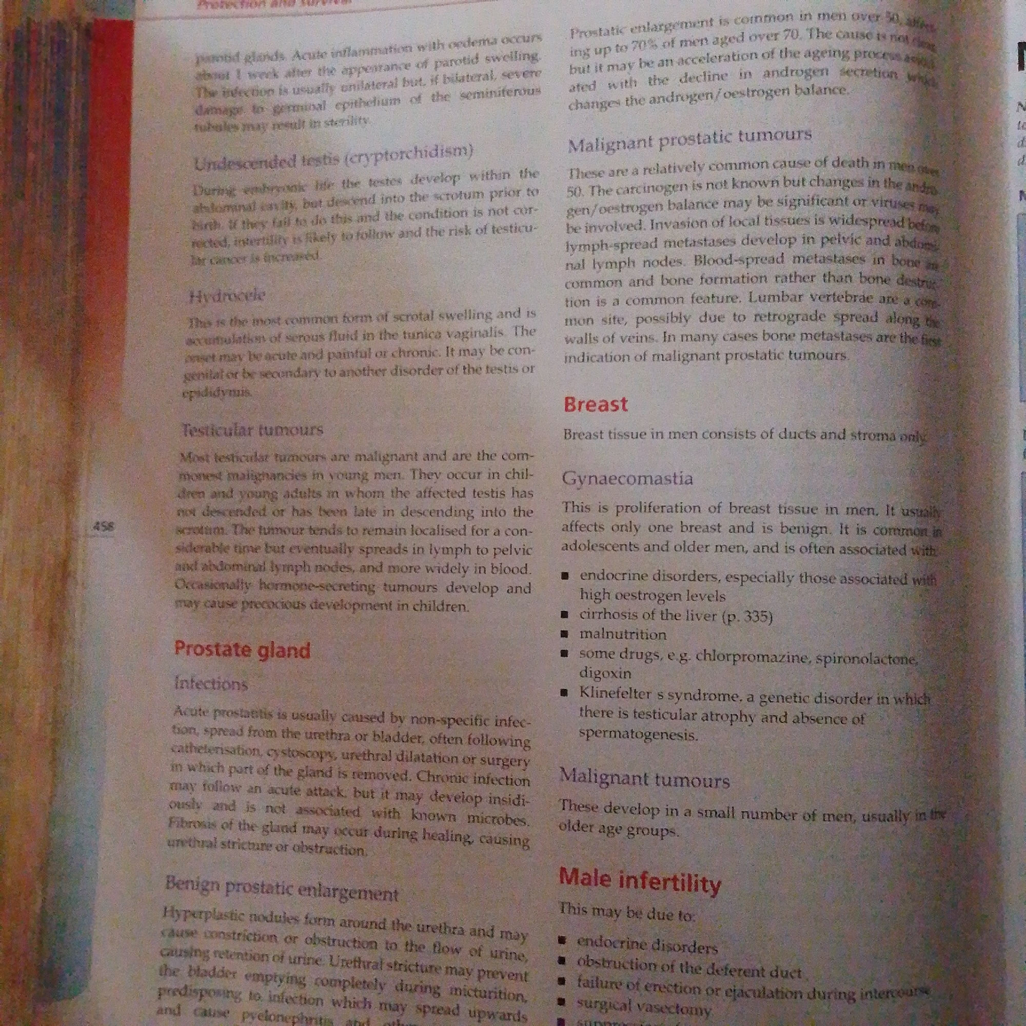 The image displays a page from a medical textbook, featuring text on various male reproductive and urological conditions. The text is presented in two columns. The left column discusses parotid glands, undescended testes, hydrocele, testicular tumors, and prostate gland issues like infections and benign prostatic enlargement. The right column covers malignant prostatic tumors, breast tissue in men, gynecomastia, and male infertility. There are no indications of the city of Jalingo, Nigeria, or any elements related to that location. The image is a close-up of the printed page, with some slight blurriness and shadow.