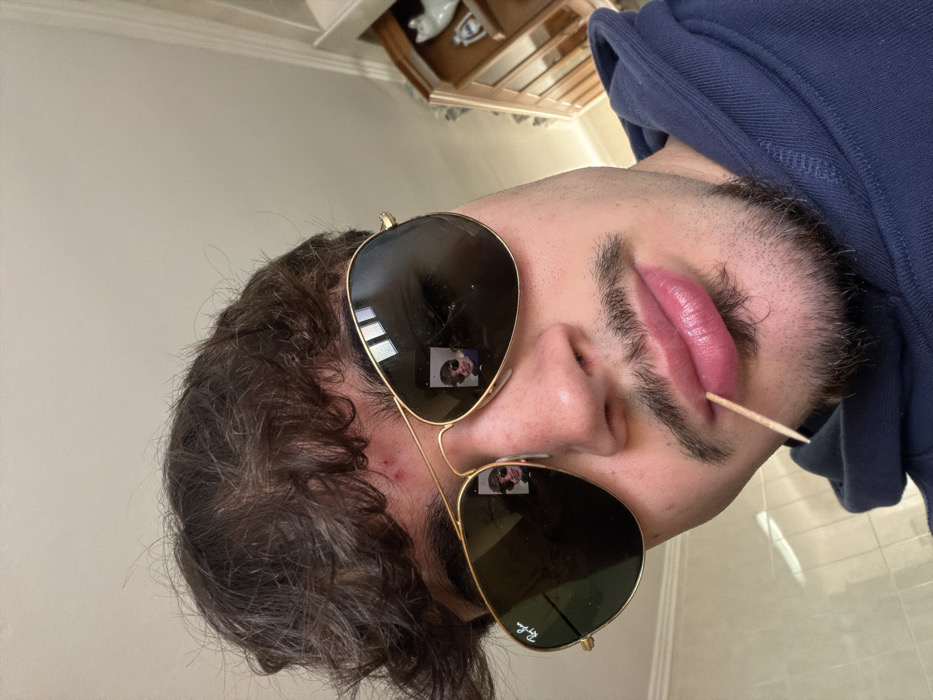 A close-up, low-angle indoor image depicts a young male subject in Vila Real, Portugal. The subject presents with dark, curly hair, a mustache, and a goatee, and an erythematous lesion is visible on his forehead near the hairline. He wears gold-framed Ray-Ban aviator sunglasses, the dark lenses of which reflect a smaller image of the subject holding a recording device, indicating a selfie. A wooden toothpick is positioned horizontally, protruding from the left side of his lips. The subject is attired in a dark blue hooded sweatshirt. The background features a light-colored wall on the left and a section of a light brown wooden display cabinet on the right, upon which a white ceramic cat figurine is visible.