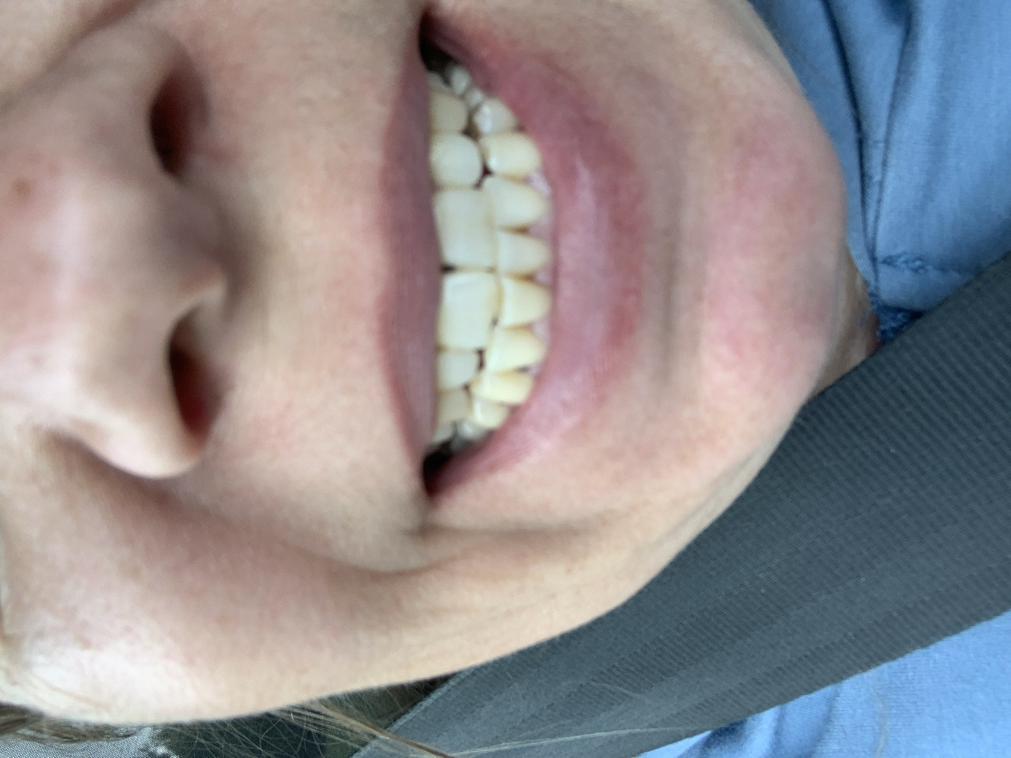 The image is a close-up, ground-level shot of a person's mouth and nose. The person is smiling, revealing their teeth, which appear to be slightly yellowed. The person is wearing a blue garment and a dark seatbelt. The background is out of focus. The image does not contain enough information to determine the location in the city of Янушкавіцкі сельскі Савет, Belarus, or any specific environmental details.