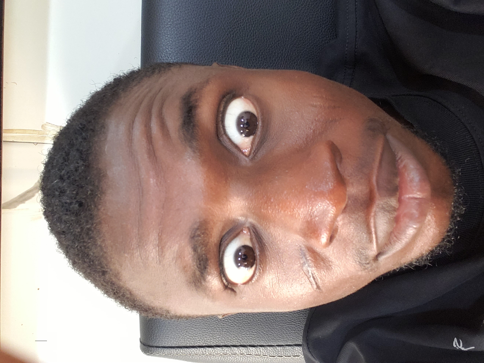 A close-up photograph features a Black male's face. The individual has dark brown eyes with noticeable whites, suggesting he may be surprised or alert. His hair is short and curly, close-cropped to the head. The skin tone is dark brown, with some shiny areas suggesting oiliness or moisture. There are visible wrinkles on the forehead. The individual has facial hair on the chin.
The background is indistinct, with a textured black surface in the lower right. A pale surface appears in the upper left corner. The image is sideways. There's no direct indication of a location in Adankolo, Nigeria, in the provided image. The photograph focuses on the person's face. No specific actions or interactions are apparent.
