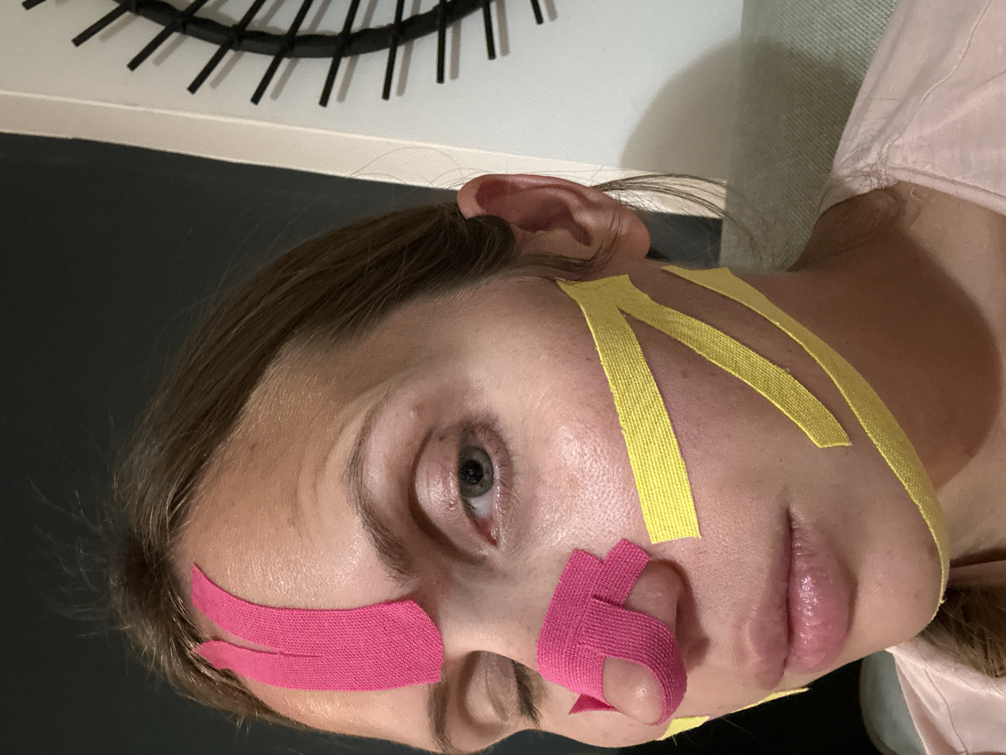An indoor, medium close-up shot features a woman with kinesiology tape applied to various parts of her face. She has light skin, light brown hair, and her left eye is open, looking directly towards the viewer. Pink kinesiology tape is visible on her forehead above her left eye and wrapped around the side of her nose and cheek on her left side. Yellow kinesiology tape is applied in multiple strips across her right cheek and temple, extending towards her ear and jawline. Her lips are slightly parted. She wears a light-colored (possibly pink or peach) shirt, partially visible on her right shoulder. The background shows a dark wall with a white trim, and a decorative black, spiky object mounted on the wall. A light green, textured surface is also visible behind her right shoulder. The woman's expression is neutral. The image suggests she is lying down or has her head significantly tilted, with the photo taken from a slightly overhead angle. There is no visible text. The location context is Fethiye, Turkey.