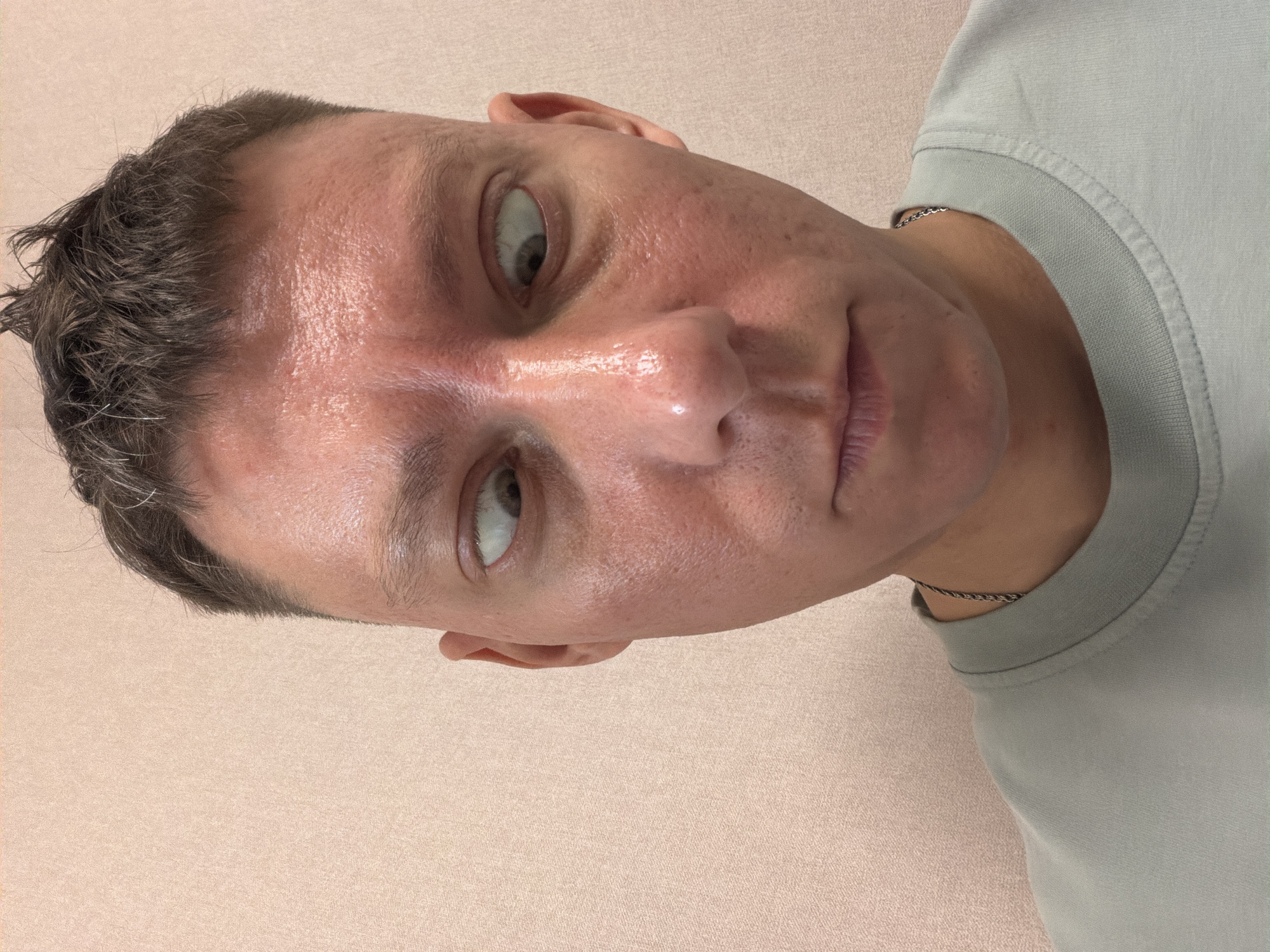 A close-up selfie of a person with short, dark hair and a light grey t-shirt shows their face turned slightly to the right. Their eyes are looking towards the left side of the frame with a cross-eyed expression. The person's skin appears slightly flushed and shiny, with visible pores and some texture. The background is a plain, light pink wall with a subtle textured pattern. A silver chain necklace is visible around the person's neck.