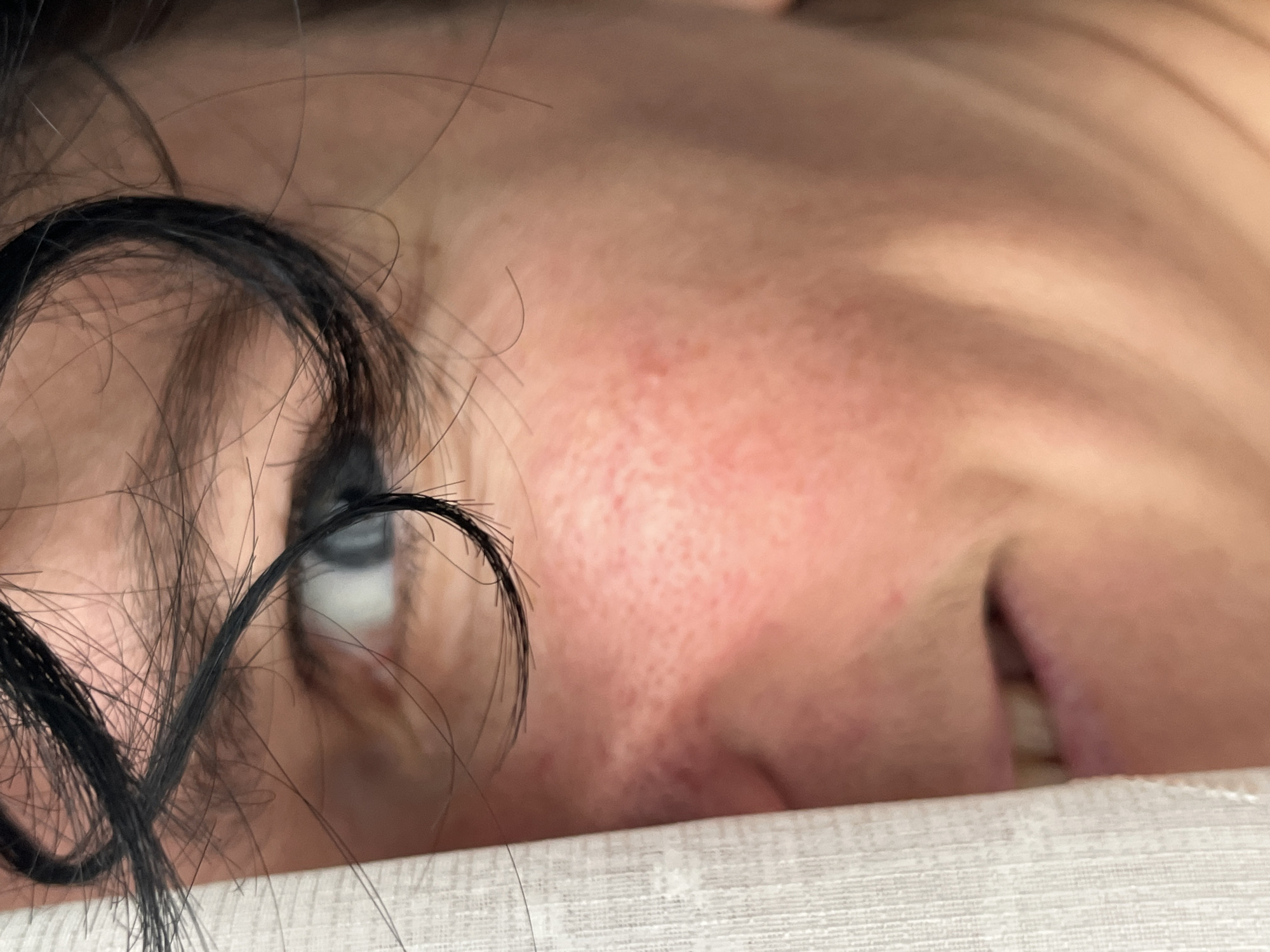 The image shows a close-up of a person's face, partially obscured by a white, textured curtain. The person's eye is visible, looking towards the right side of the frame. Strands of dark hair fall across their forehead and eye. The skin on their cheek is flushed, and there appear to be some blemishes or texture variations. The lower part of their mouth is also visible, with teeth showing. The background is out of focus, suggesting an indoor setting. The image does not provide any information that would allow for the determination of its location within ღრმაღელის თემი, Georgia.