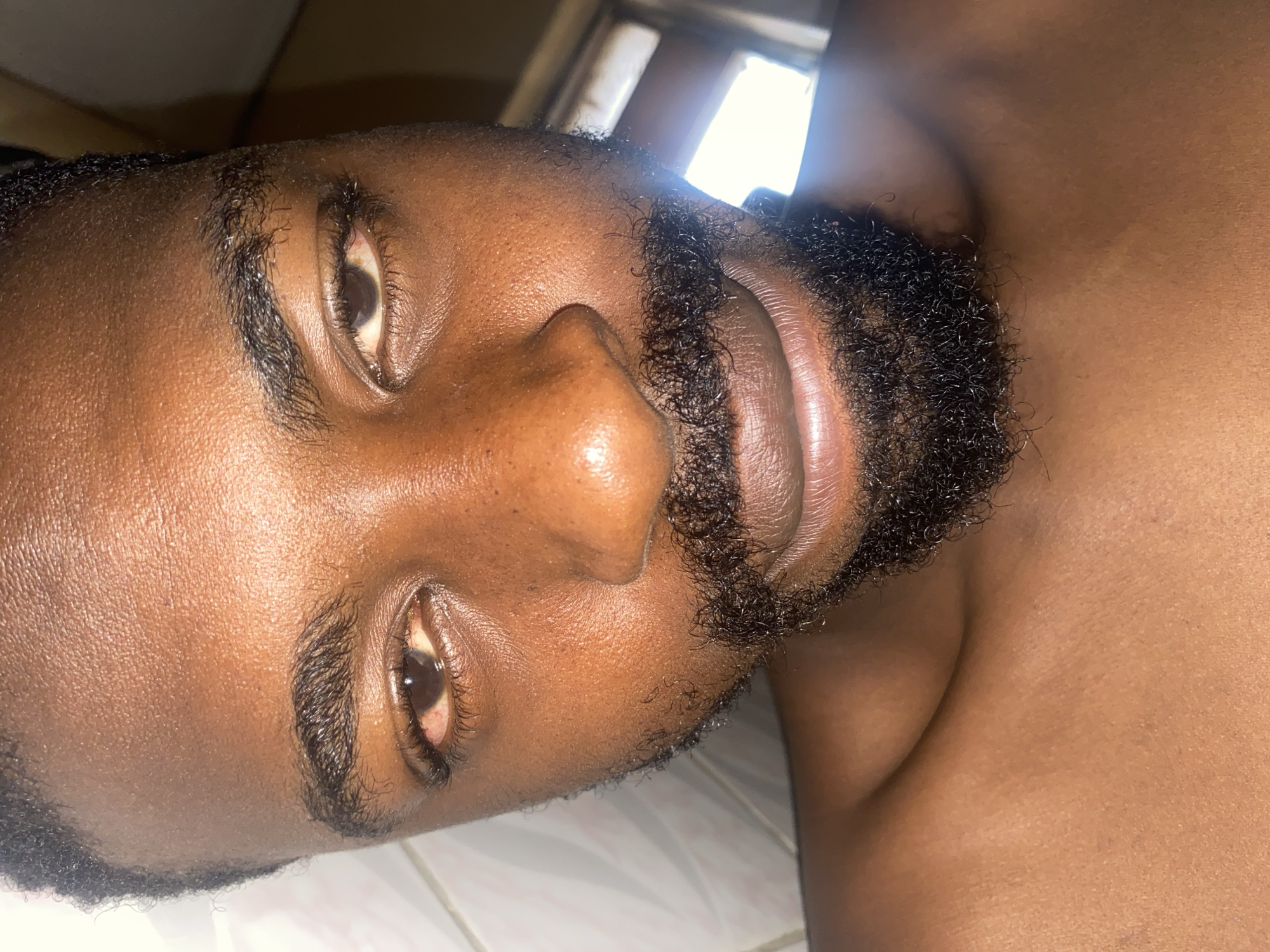 A close-up, rotated portrait captures the head and upper torso of a dark-skinned person, likely male, lying down indoors. The individual looks directly towards the camera with a neutral expression. Their dark eyes are prominent, with visible blood vessels and a slight yellowish tint in the sclera. Dark, curly eyebrows frame the eyes. A well-groomed, dark, and curly beard covers the chin, jawline, and mustache area. The nose is broad and the lips are full.
The skin appears smooth and somewhat shiny, possibly due to lighting. The background is softly blurred but shows a light-colored surface, possibly a tiled floor or wall, and a bright light source, suggesting an indoor setting with ample illumination, potentially during the day. The person's bare shoulder and neck are visible on the right side of the frame. There is no visible text or identifiable objects besides the person. The image provides a detailed view of the subject's facial features and skin texture.