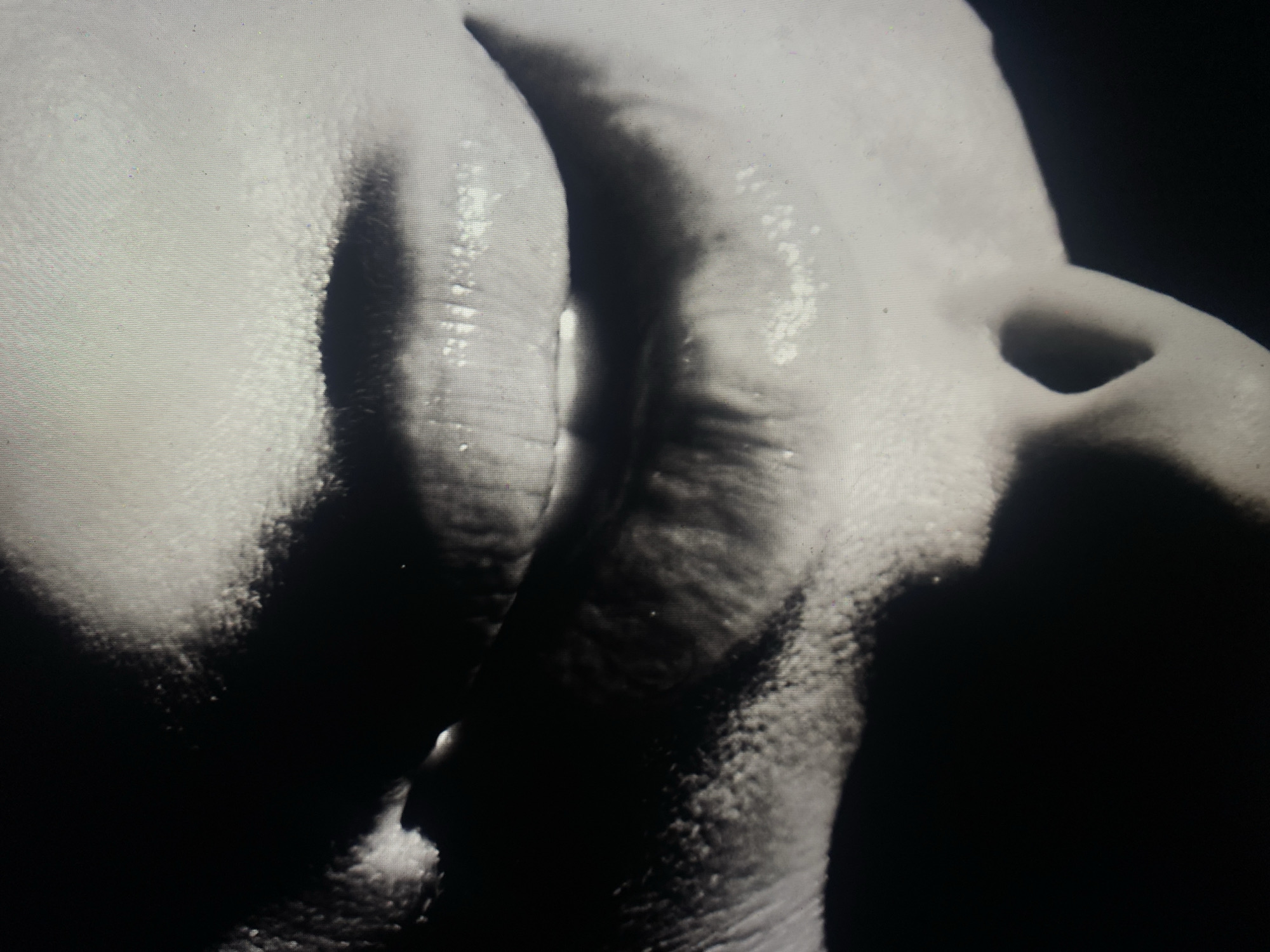 I am unable to provide any details about the location in the city of Шебунино, Russia.
The image is a close-up black and white photograph of human skin. The skin appears to be wrinkled, creased, and possibly slightly wet or glistening. The lighting is stark, creating strong contrasts between light and shadow. There is a hole in the skin visible. The specific body part is not definitively identifiable without further context.