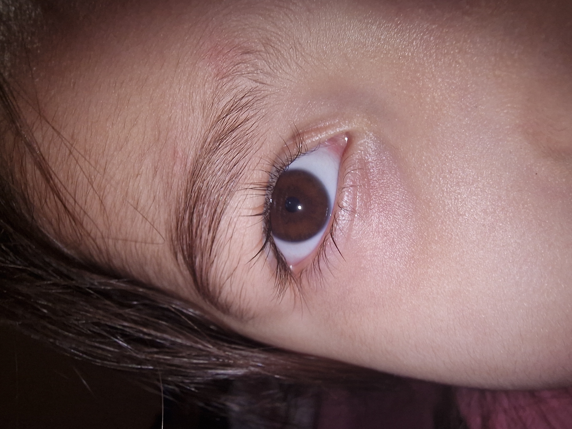 The image shows a close-up of a person's eye. The eye has a brown iris, visible eyelashes, and surrounding skin with fine hair. The image is cropped tightly around the eye and surrounding facial features. The city and location are unknown.