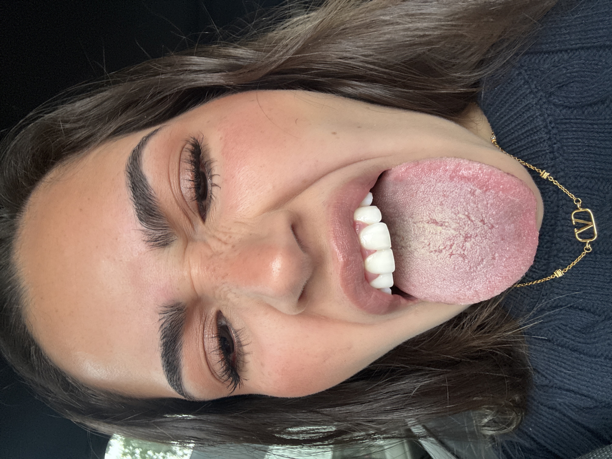 A woman is depicted from the neck up, looking directly at the viewer with her head tilted to the right. Her tongue is extended out of her mouth, displaying a white coating. She has dark hair and fair skin, with visible freckles around her nose. Her eyes are closed, and her face is scrunched up, indicating a playful or humorous expression. She wears a dark-colored sweater and a gold necklace with a designer logo is visible near her neck. The background appears dark, possibly indicating an indoor setting. The image does not contain enough information to determine the location in the city of Puebla, Mexico.