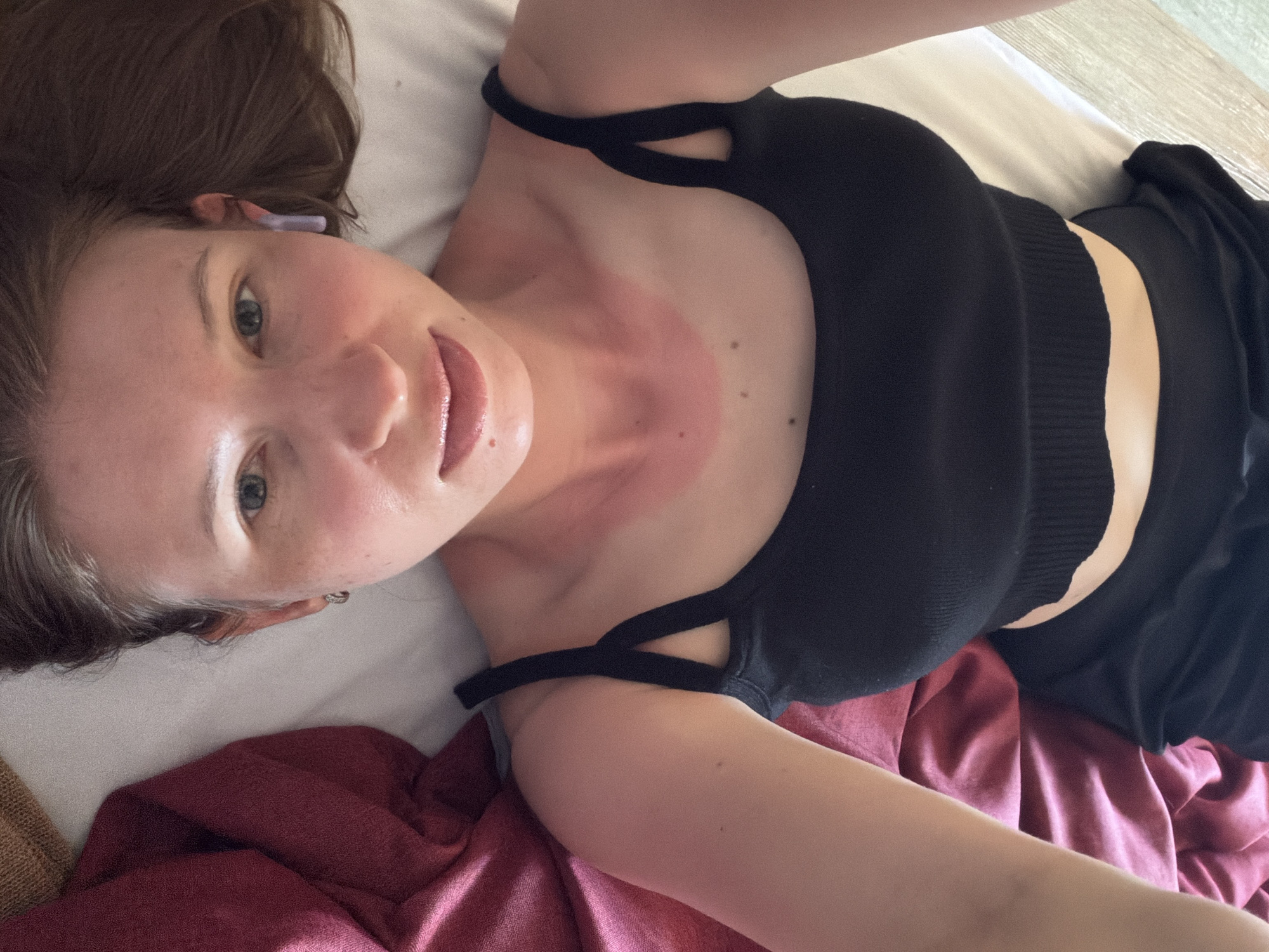 The image shows a person lying on a bed, with their head turned towards the camera. The person is wearing a black top that exposes their shoulders and collarbone. There is visible redness on the person's neck and collarbone area, suggesting sunburn or irritation. The person has fair skin, brown hair, and blue eyes. They are wearing a small silver earring in their left ear. The background consists of white bedding and a draped burgundy fabric. The image is taken from an overhead perspective, with the person positioned upside down relative to the camera. The scene does not provide any specific clues about the location being in Gangneung-si, South Korea.