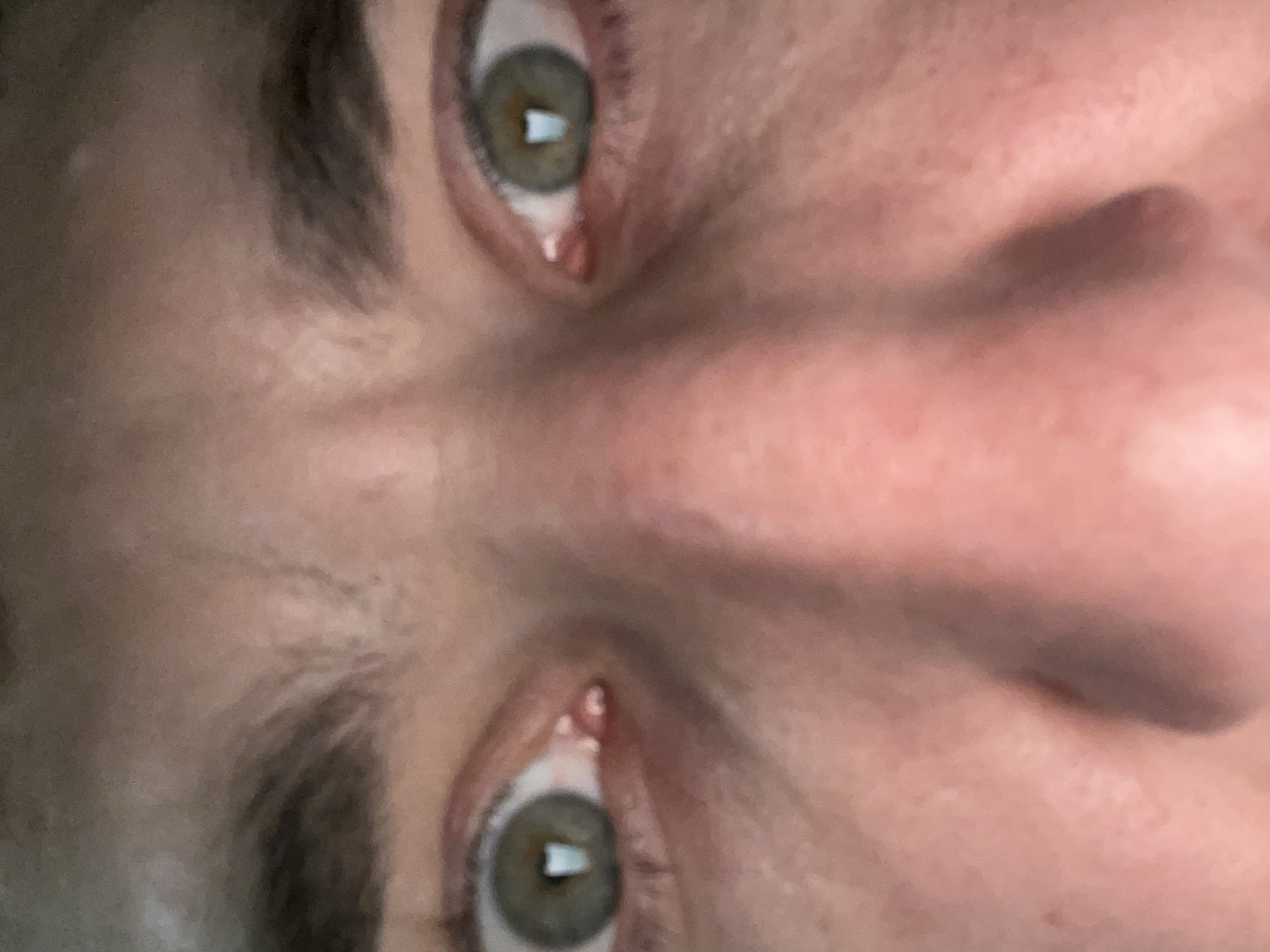 This is a close-up, vertically oriented, media file showing a person's eyes. The focus is on the area around both eyes, with the nose bridge prominently featured in the center. The skin appears fair-toned with some subtle variations in color. The eyebrows are dark and well-defined, arching over the eyes. The eyes themselves are a striking green or hazel color with visible reflections in the pupils, suggesting an indoor or light-filled environment. The eyelids are visible, and the lower eyelids show a bit of redness, possibly from irritation or allergies. There are no other discernible objects, background elements, or clear indicators of a specific time of day or weather. The overall impression is a very tight crop of facial features. No text is visible in the image.