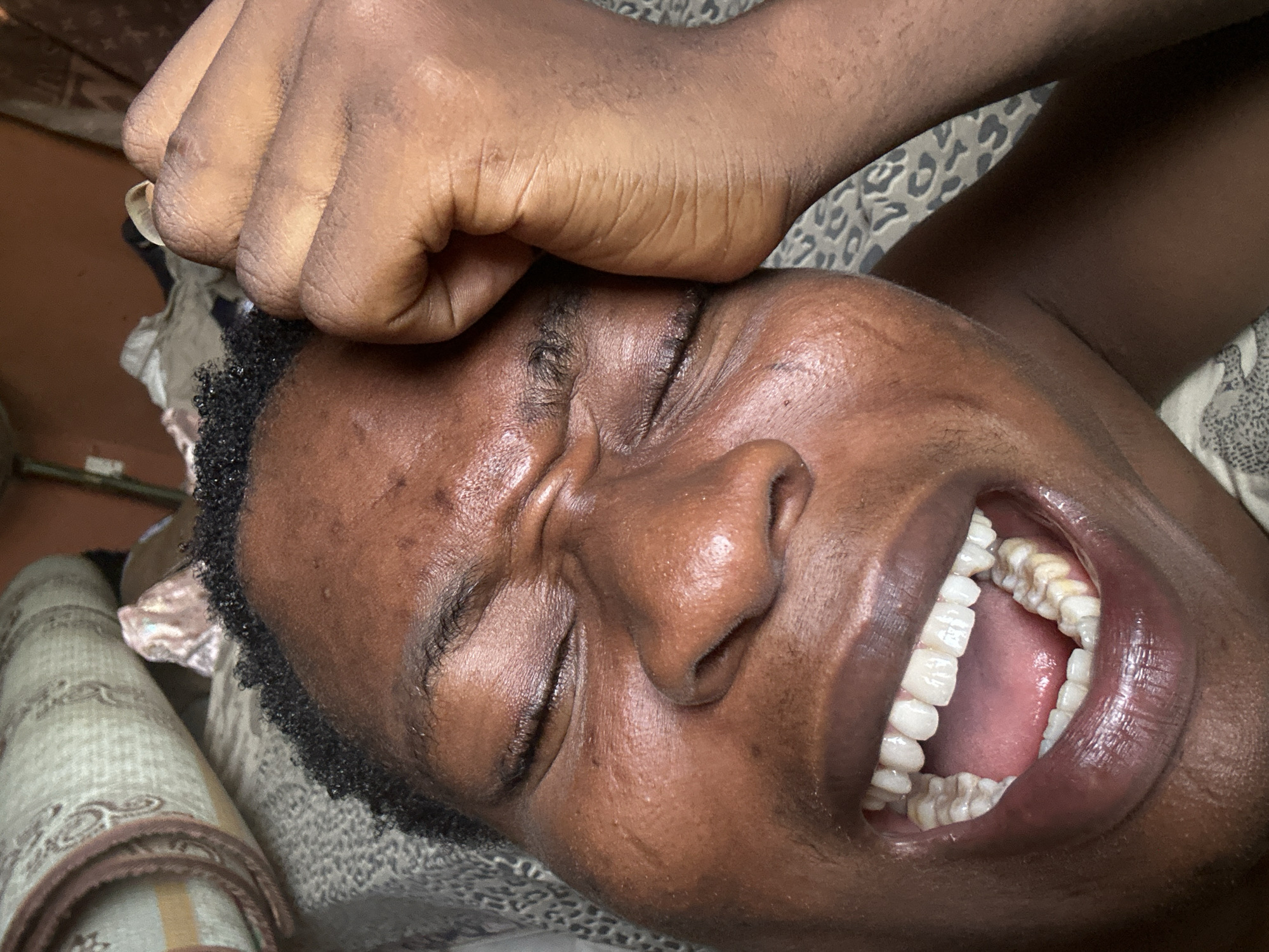 A dark-skinned individual is lying down, eyes closed, with their right hand pressed against their forehead. Their mouth is open, revealing their teeth. The background is blurred, but suggests a patterned surface and possibly a rolled-up rug. The location and city are unknown.