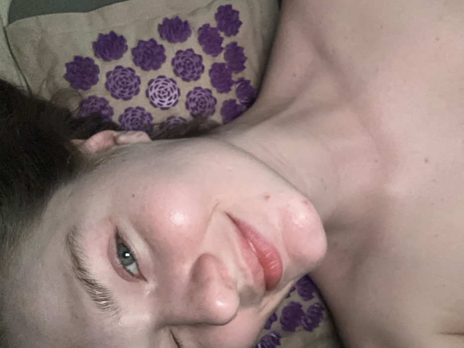 The image presents an overhead, close-up view of an individual, likely a young adult, lying on their back. The visible portion includes the person's upper chest, neck, and the right side of their face, which is slightly angled towards the camera. The skin tone is fair, with some areas of localized redness on the cheeks. The individual has light-colored eyes, appearing blue-green, and their right eye is partially visible and open. A faint smile or smirk is discernible, with the lips slightly parted and appearing moisturized. Dark hair is visible along the lower right edge of the frame. The person's head and neck rest on an acupressure mat, which is beige or light brown. This mat is patterned with numerous purple, rosette-shaped, spiky elements arranged in a grid. No identifiable environmental details are present to determine a specific location within Matiushino, Russia, or any other setting.