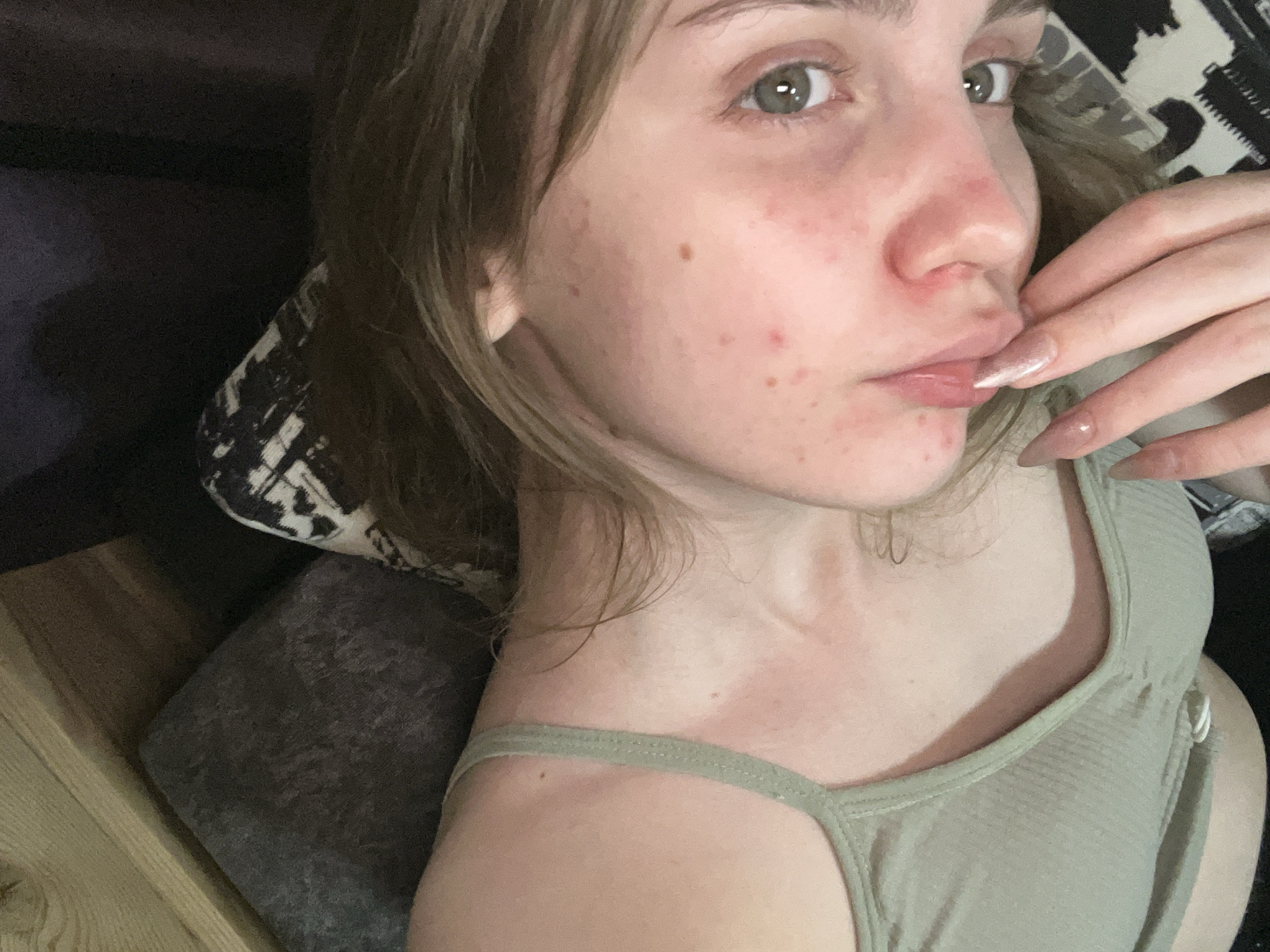The image shows a close-up, overhead shot of a young woman lying down. She is wearing a light green ribbed tank top. Her face is partially visible, with her right eye and part of her nose and lips in focus. Her skin appears to have some redness and blemishes. Her hand, with long, light brown, glittery nails, is resting near her mouth. The background is dark and out of focus, but suggests an indoor setting with what appears to be wooden furniture and patterned fabric. There is no discernible information within the image that would place the scene in Ashkadar, Russia, or any specific city.